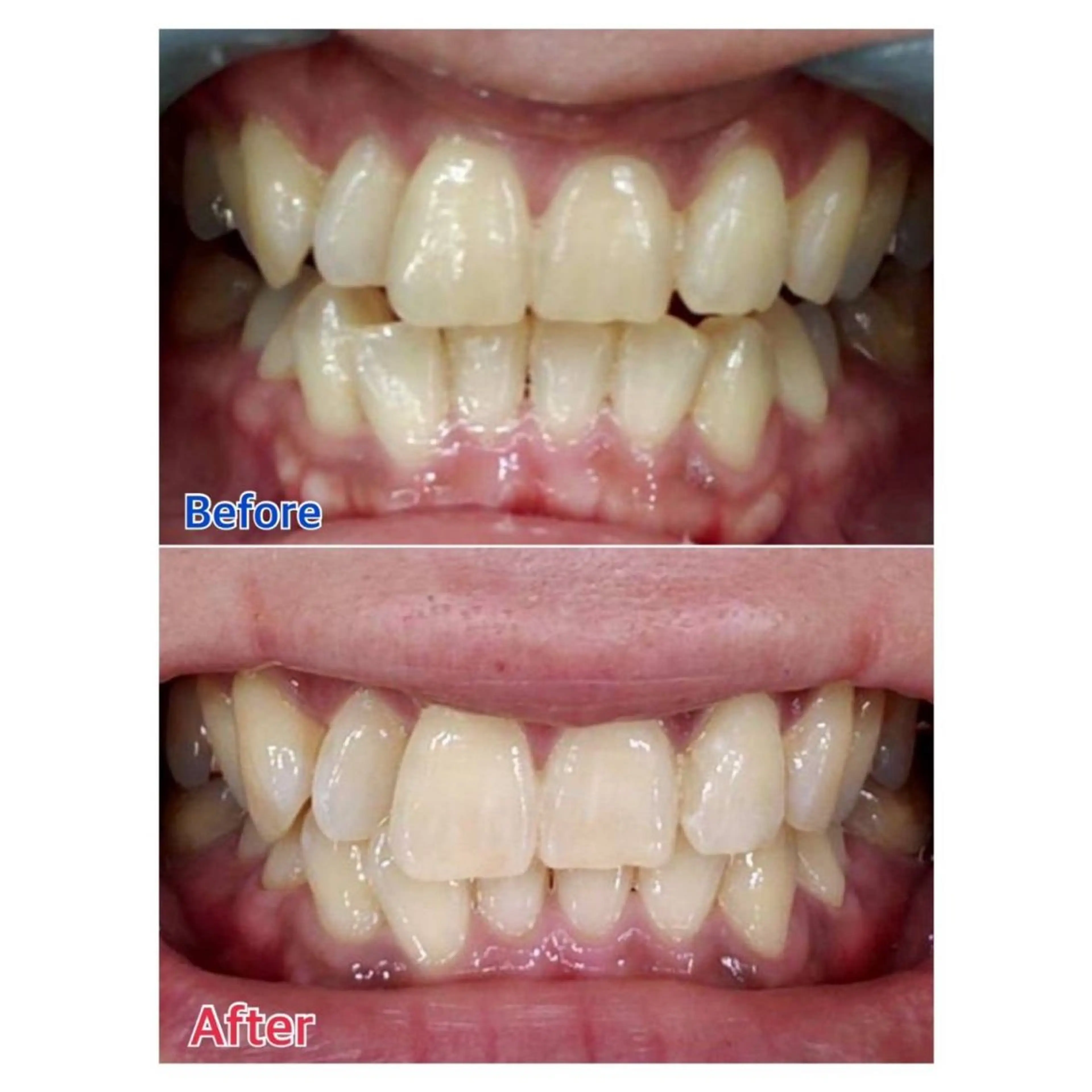 MBEAUTYSALON 千葉店・京成大久保所属・Melty 輝のその他イメージ