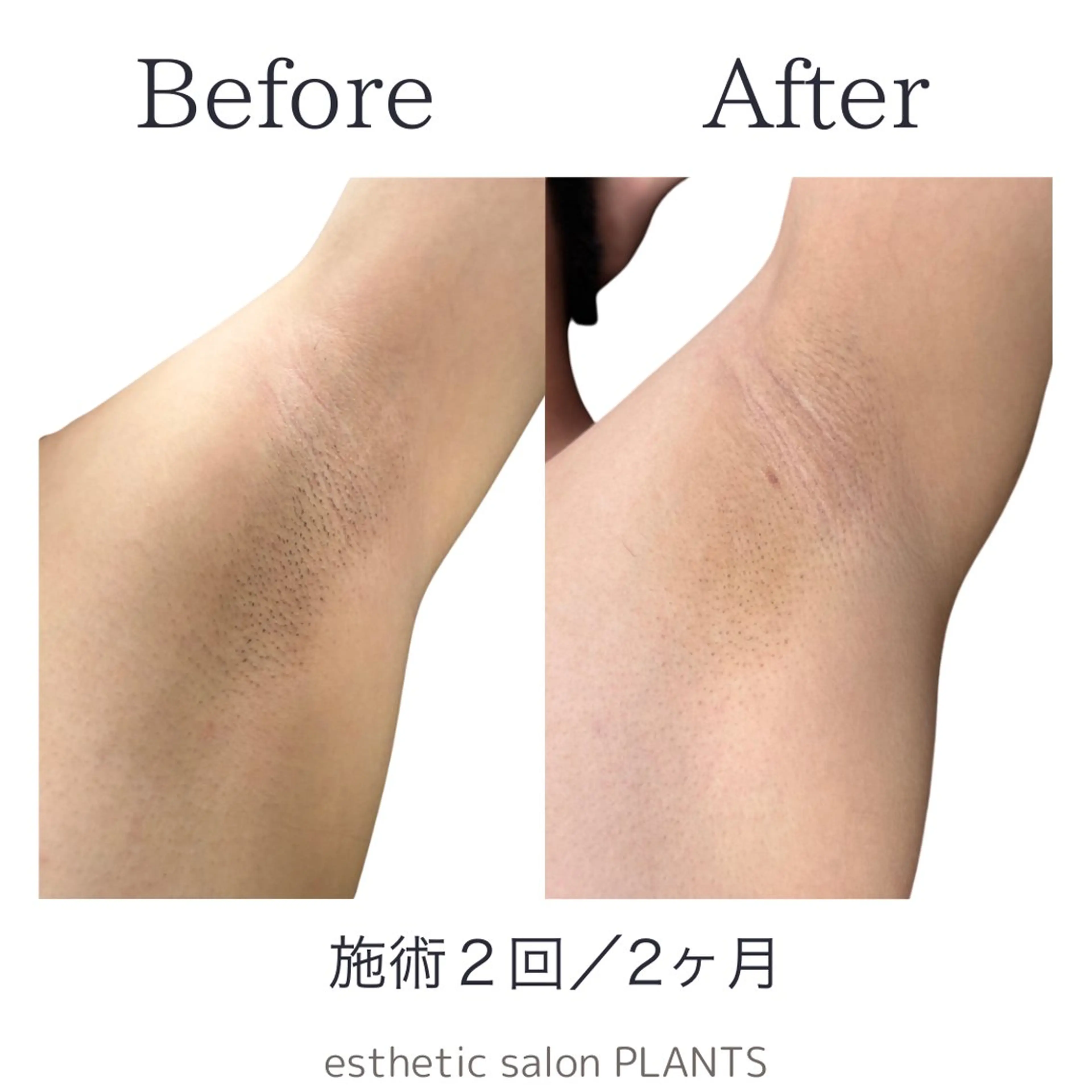 メンズ 脱毛 esthetic salon PLANTS所属・エステティックサロン PLANTSのエステ・リラクイメージ