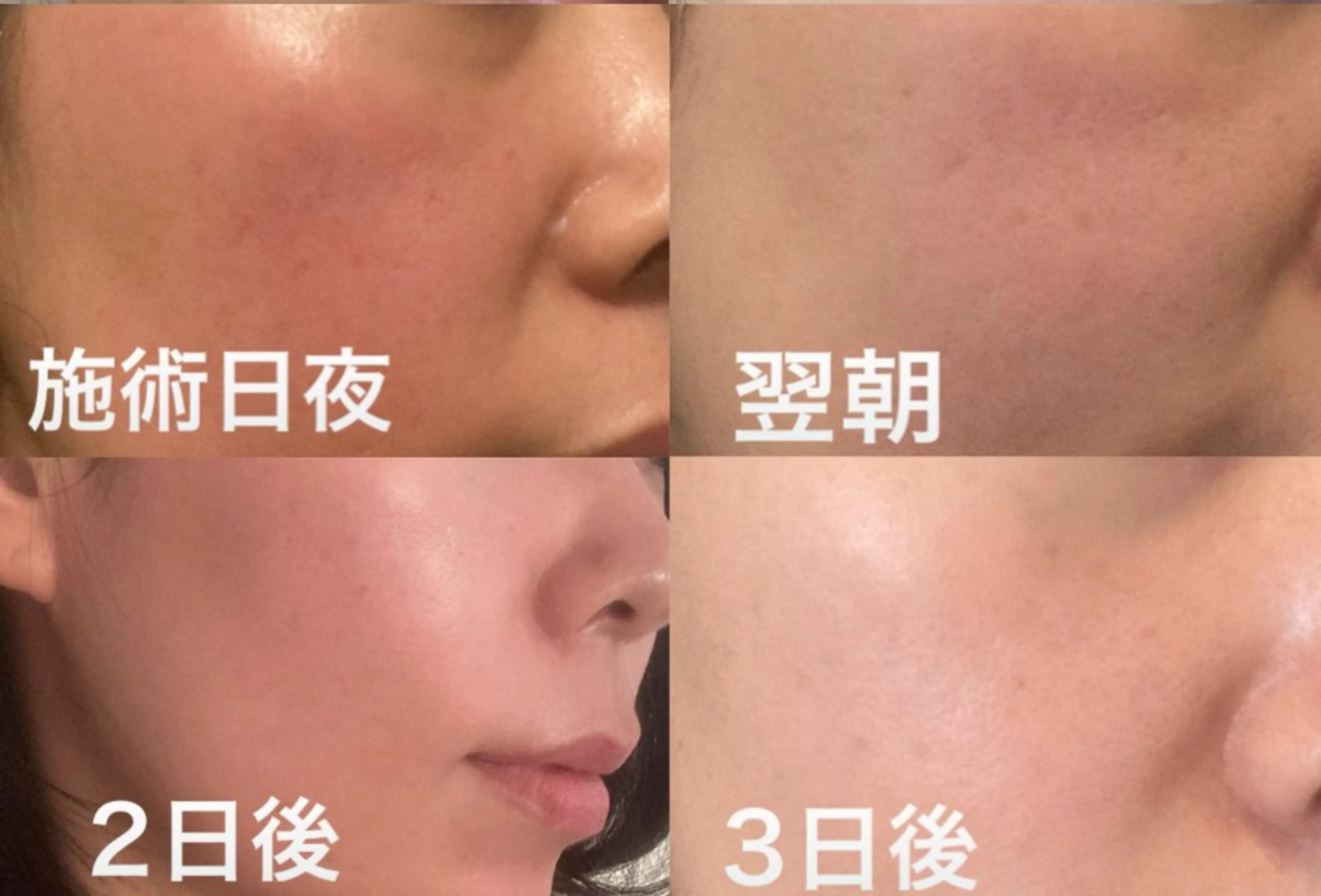 エステ UN・MULAN (大田　瑶子)のエステ・リラクイメージ