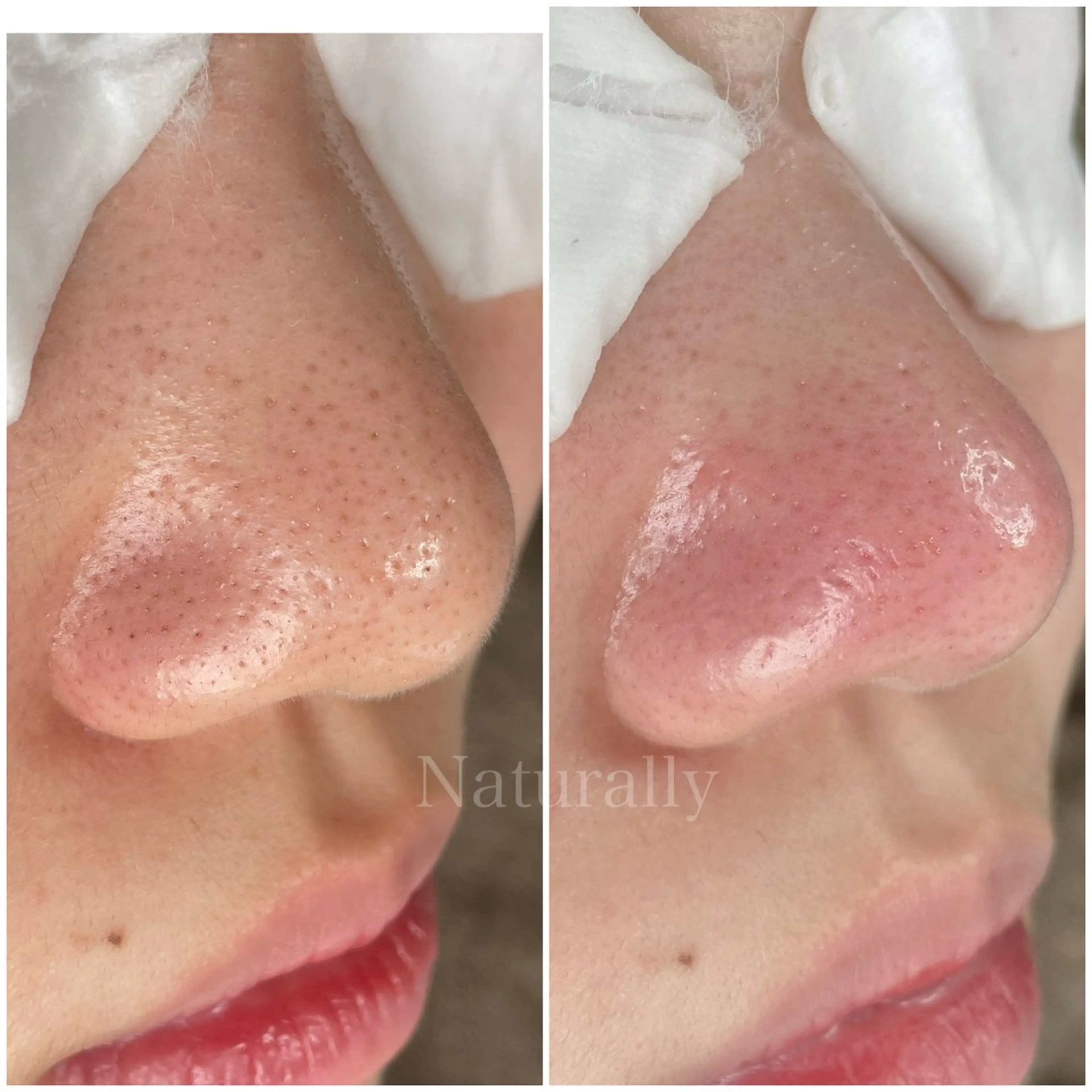 Naturally ナチュラリーのマツエク・マツパデザイン