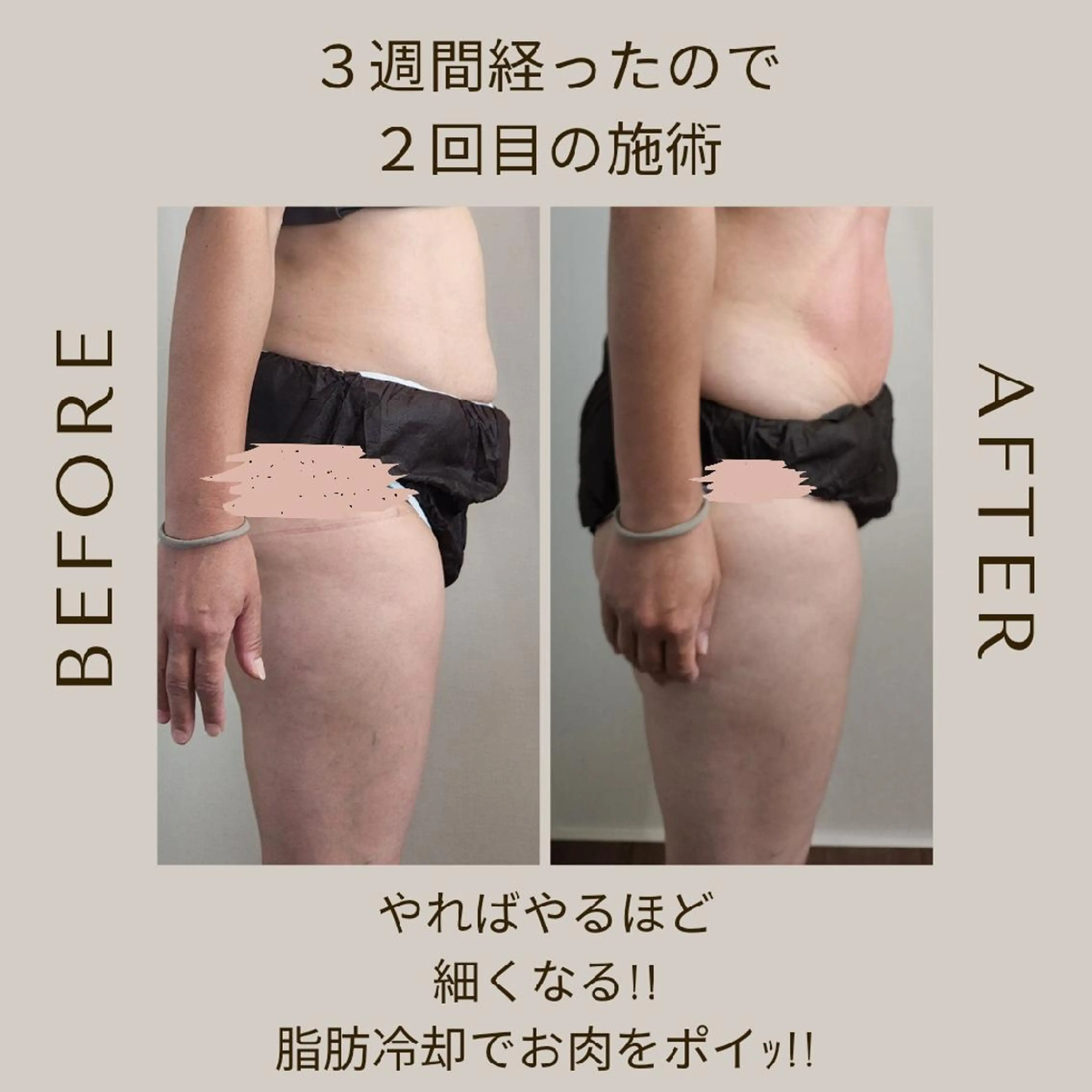 痩身・脂肪冷却サロンcoconoix [ｺｺﾉﾜ]所属・痩身・脂肪冷却サロン coconoix のエステ・リラクイメージ