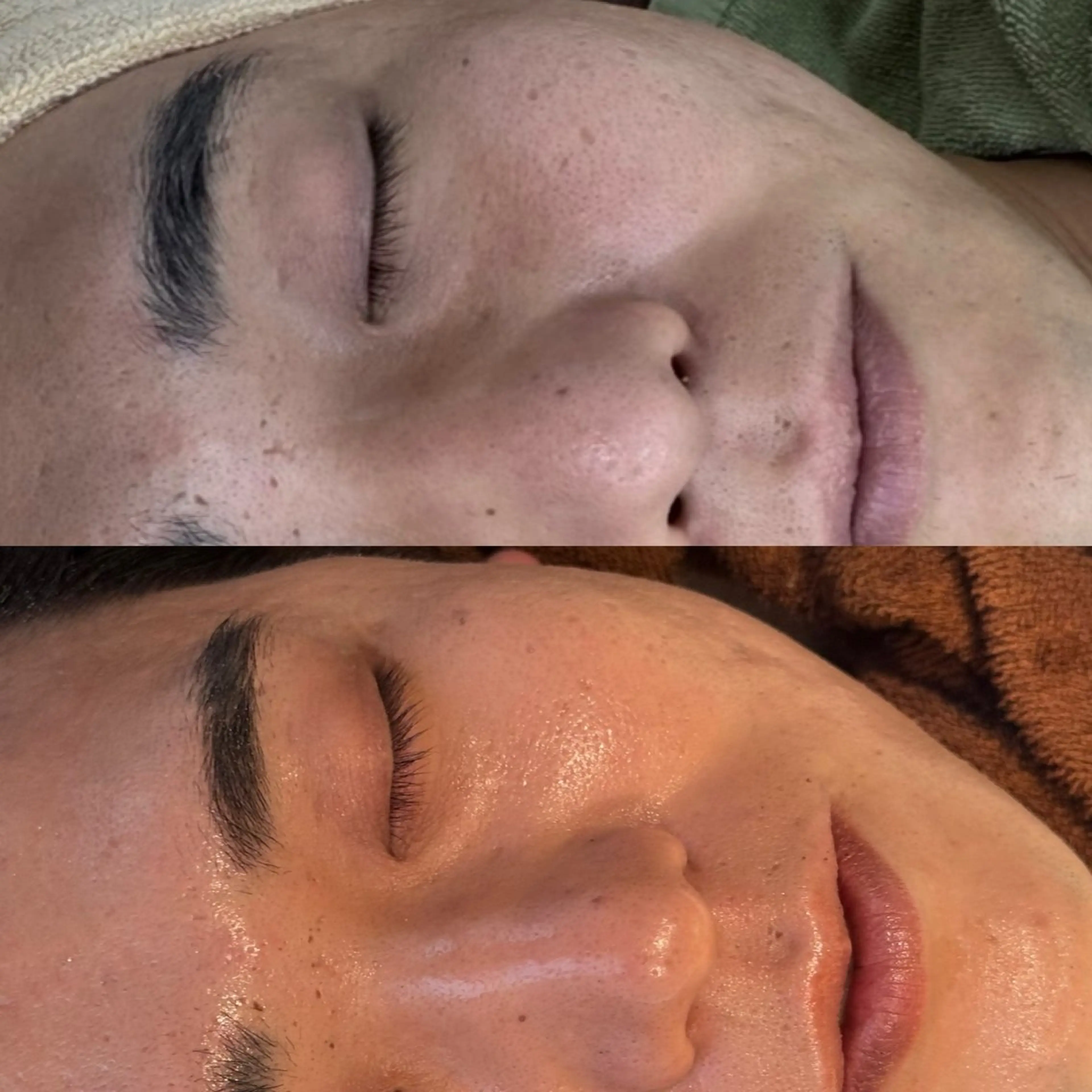 エステ skinity所属・ピーリング専門サロン skinityのエステ・リラクイメージ