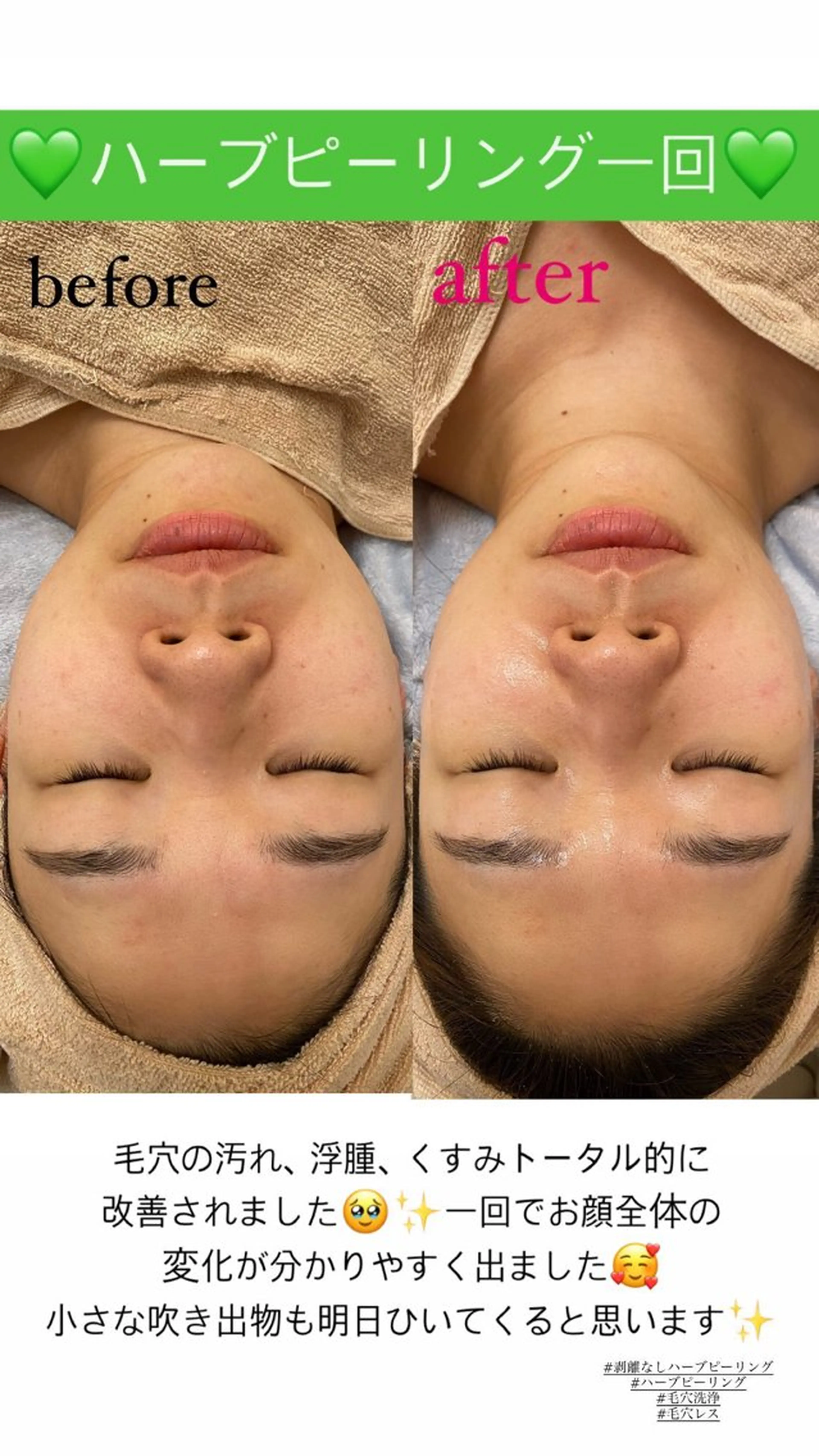 エステ Salon de Lino 御器所のエステ・リラクイメージ