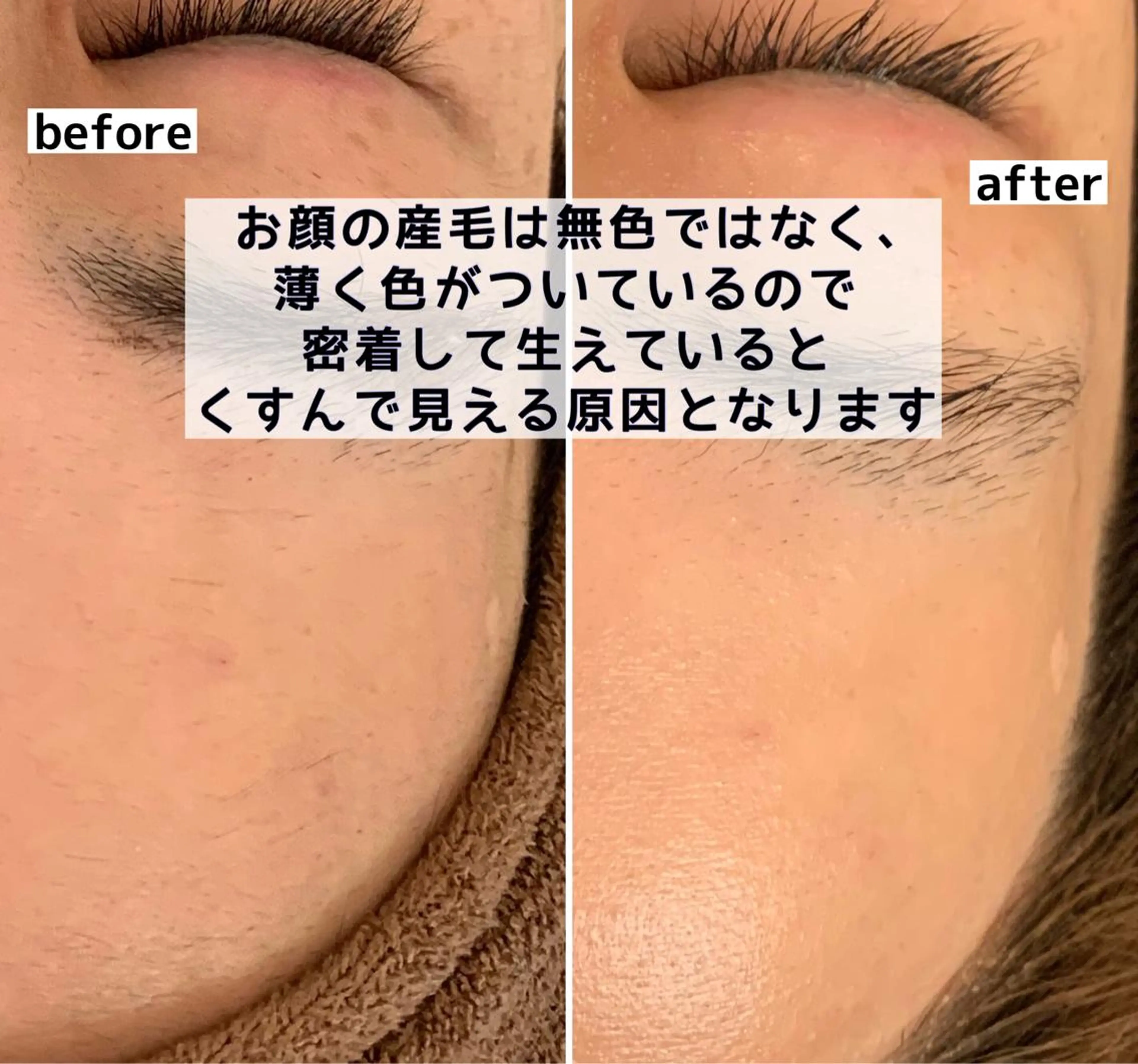 美肌コラーゲン脱毛SINCERITE【サンセリテ】所属・瀬野 のぞみのエステ・リラクイメージ