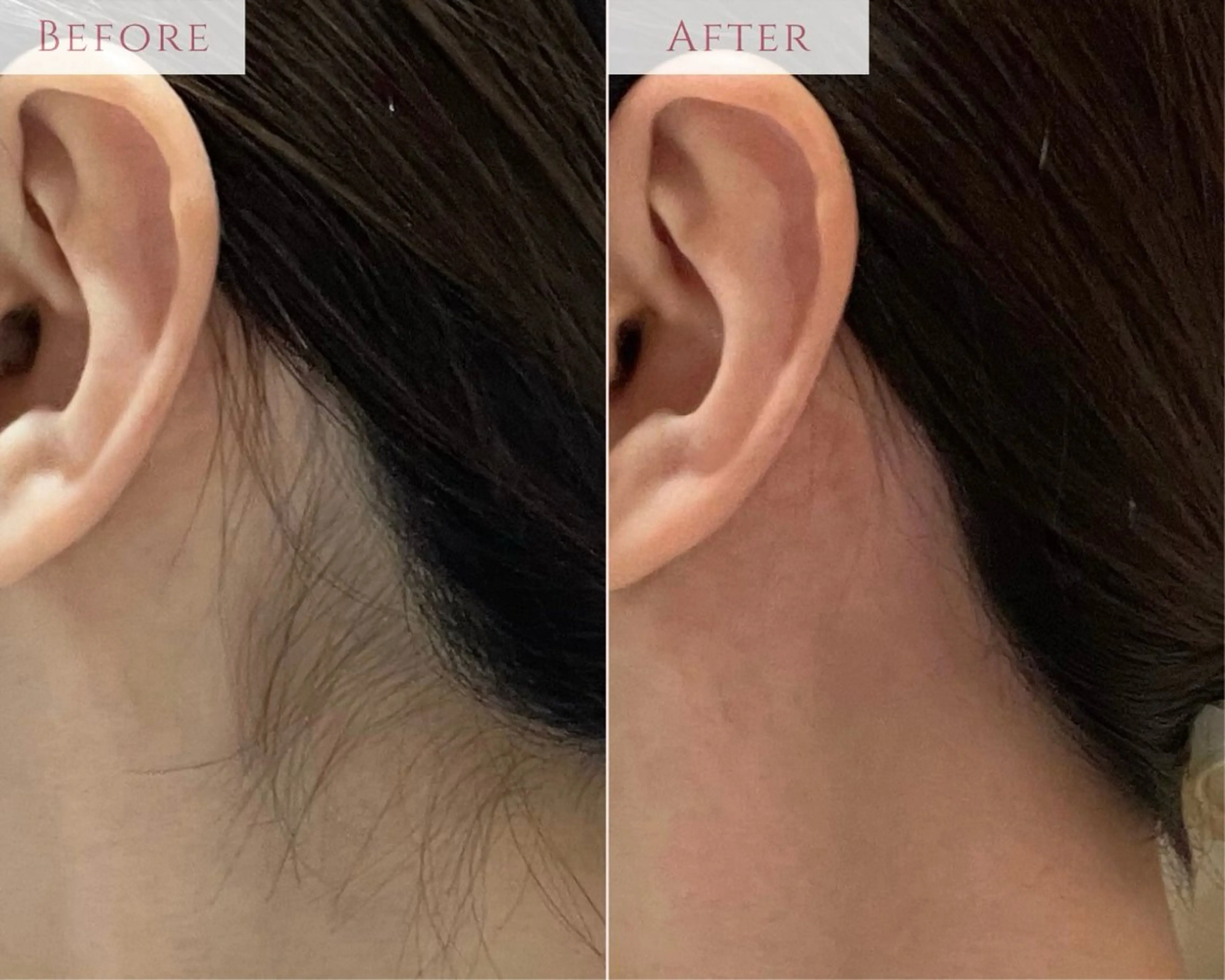 脱毛 肌質改善専門サロン Bellmi/心斎橋のエステ・リラクイメージ