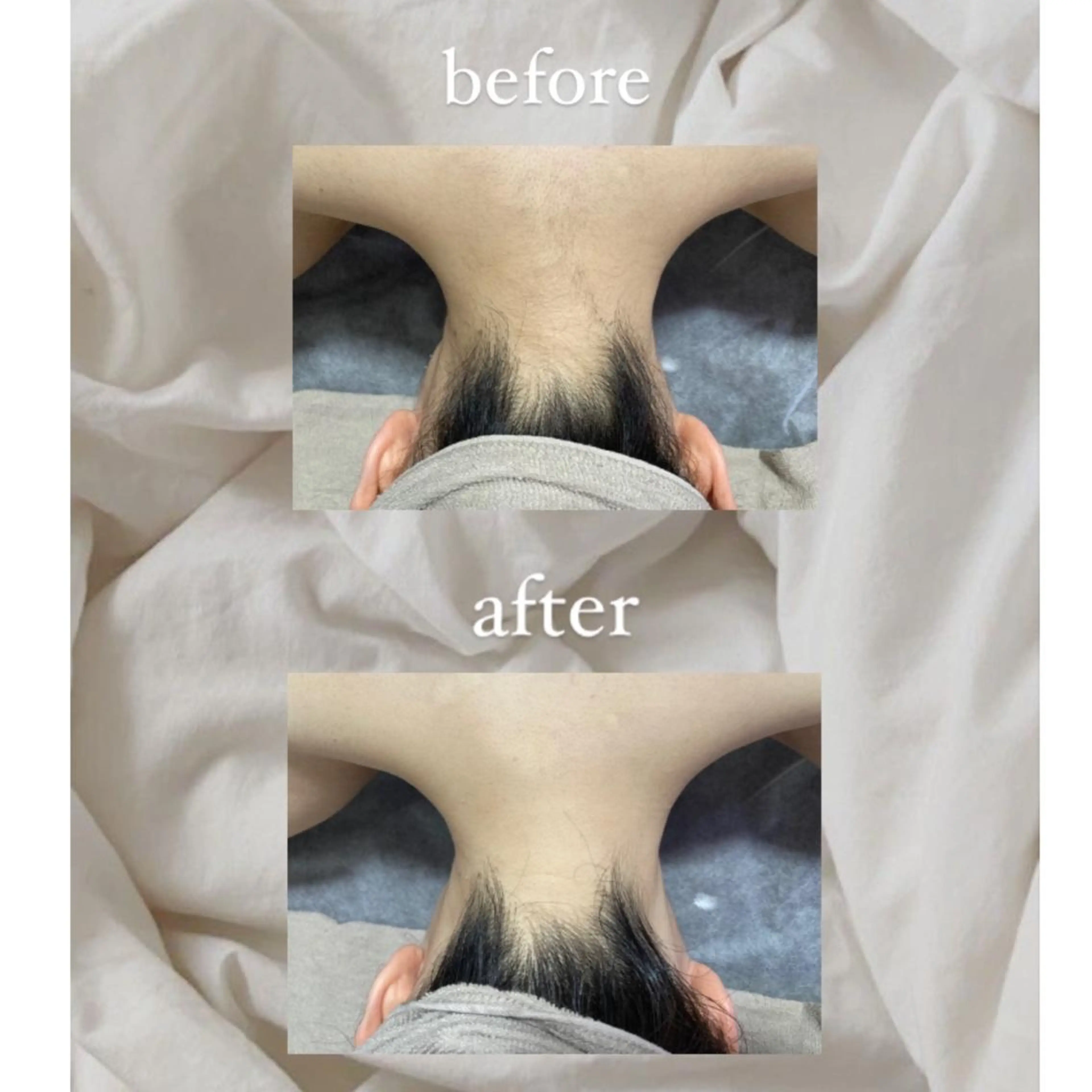 脱毛 crescent所属・【韓国肌管理・脱毛】 クレセントのエステ・リラクイメージ