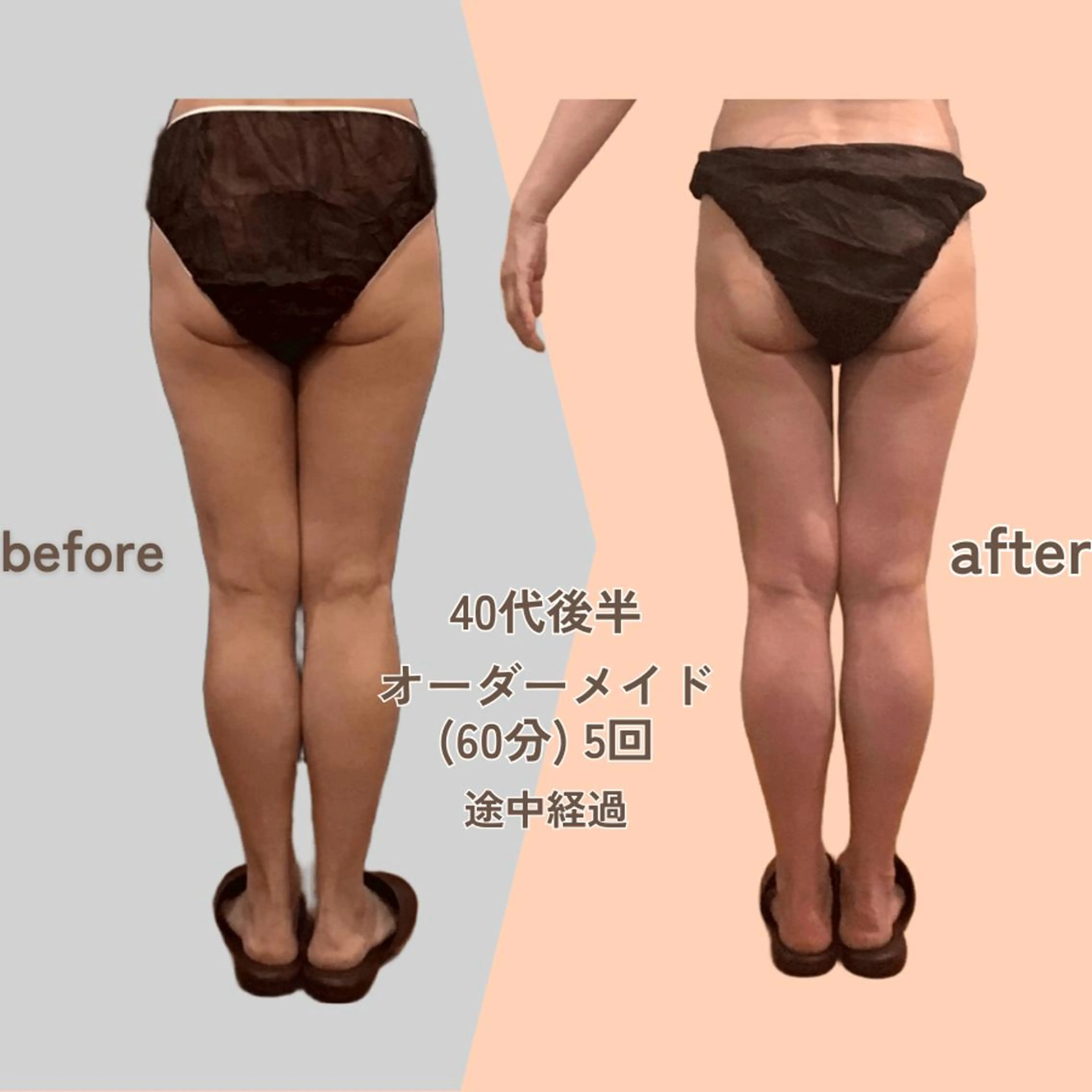 痩身エステ Julien麹町店のエステ・リラクイメージ