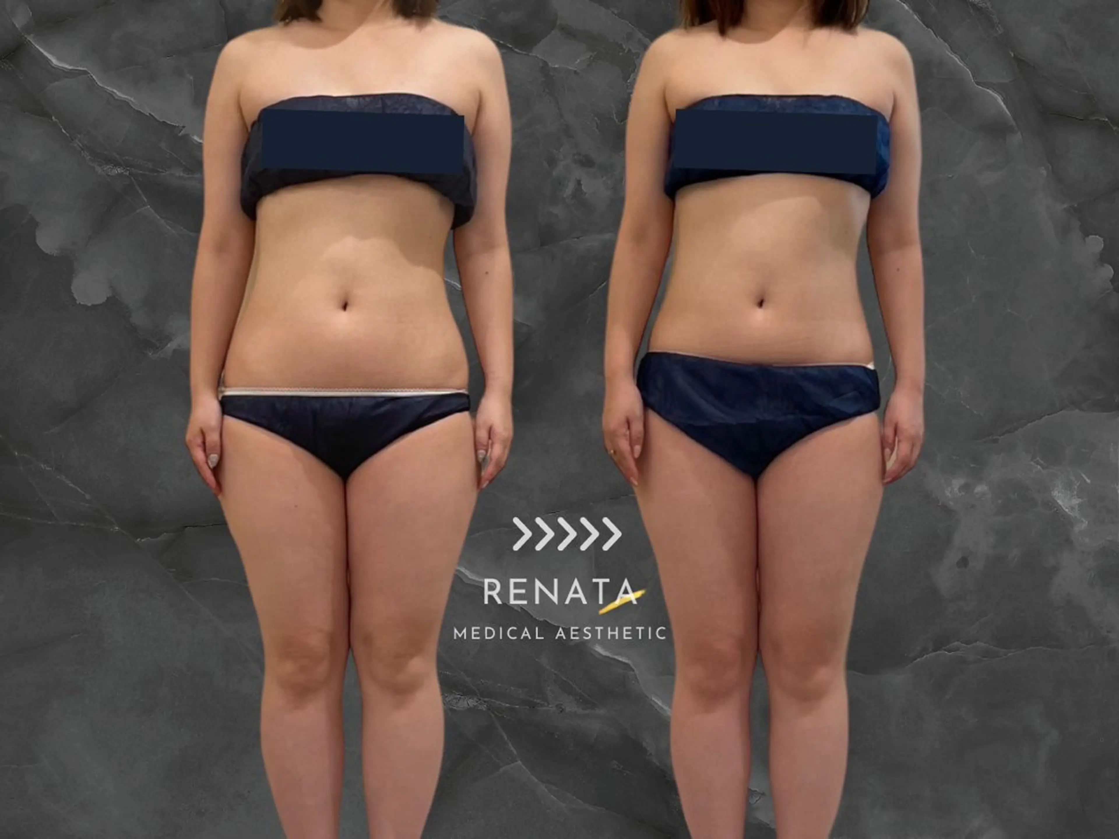 RENATA🕊 脂肪冷却専門店六本木のエステ・リラクイメージ