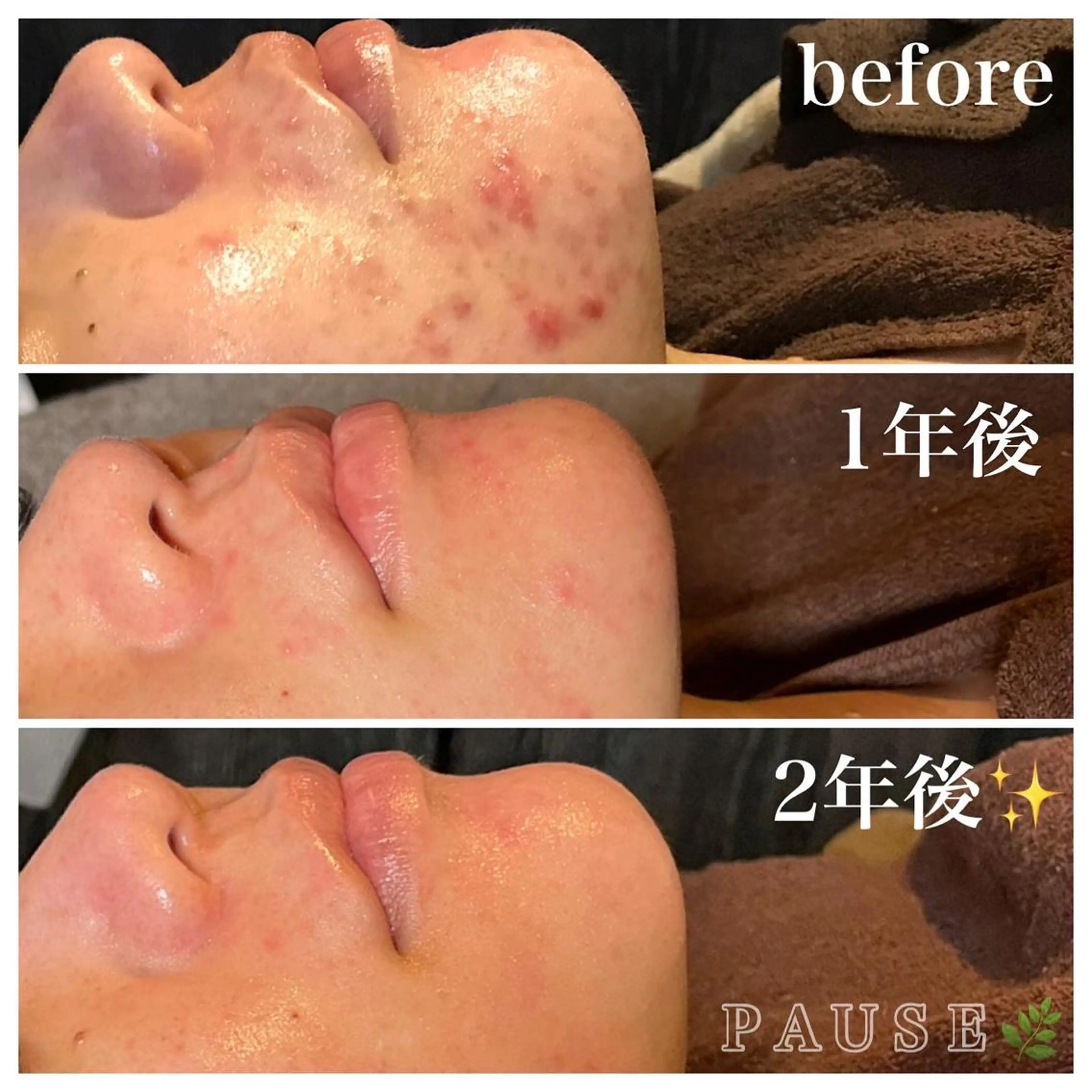 エステ 浜野 恵美のエステ・リラクイメージ