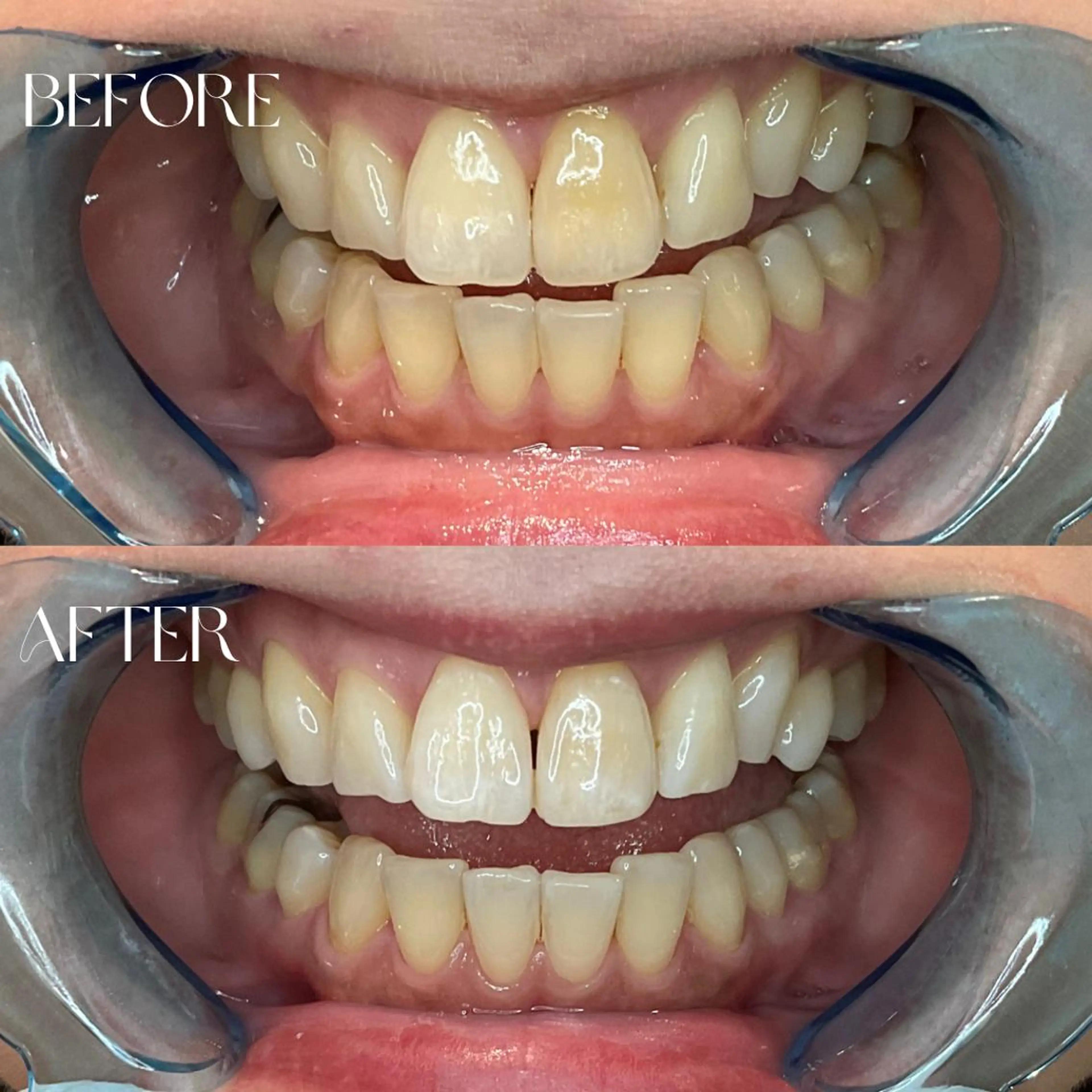 エステ リラク B-st. 下北沢のエステ・リラクイメージ