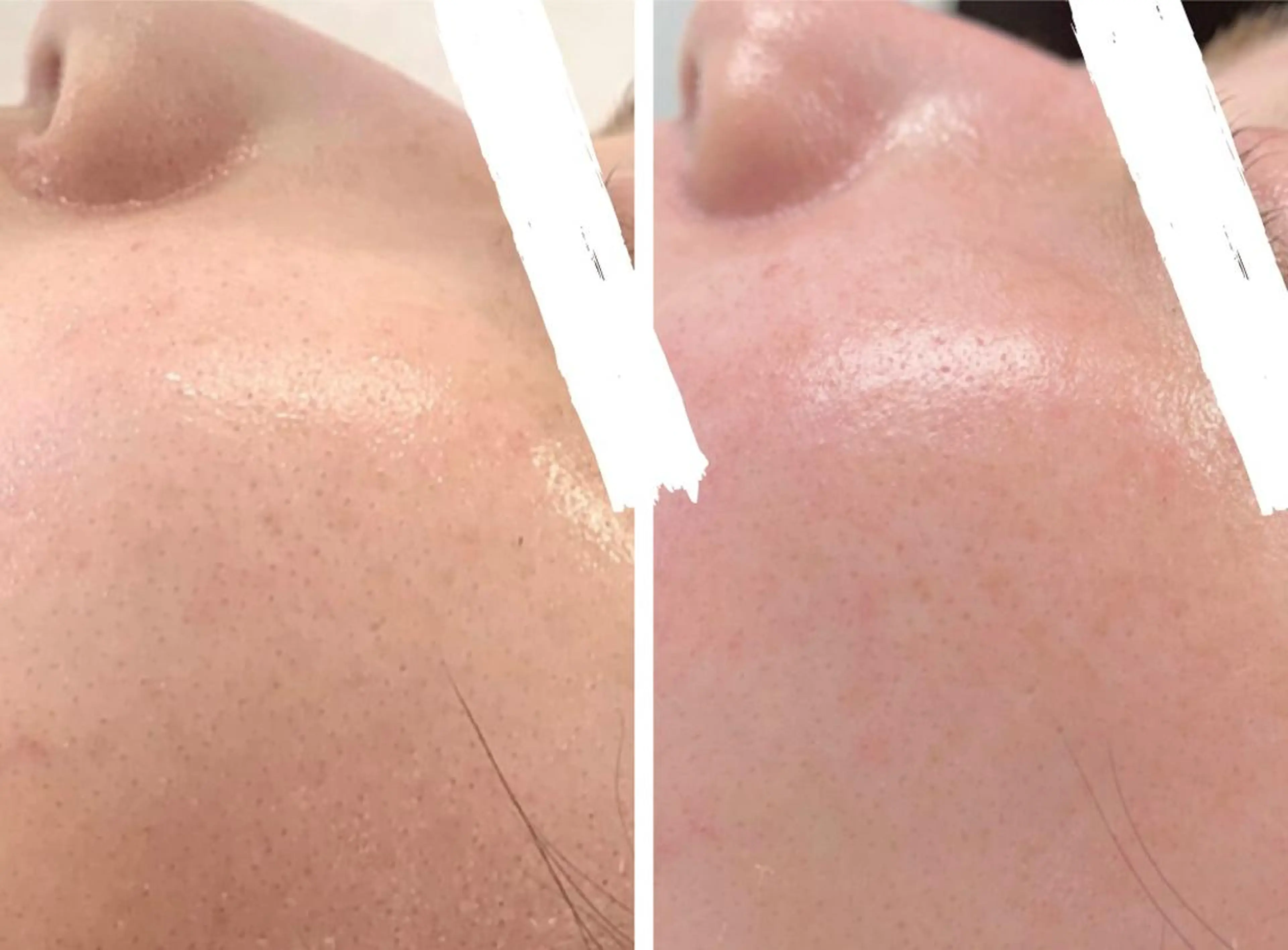 凛とひらくデコルテ Spa　“koti”のエステ・リラクイメージ