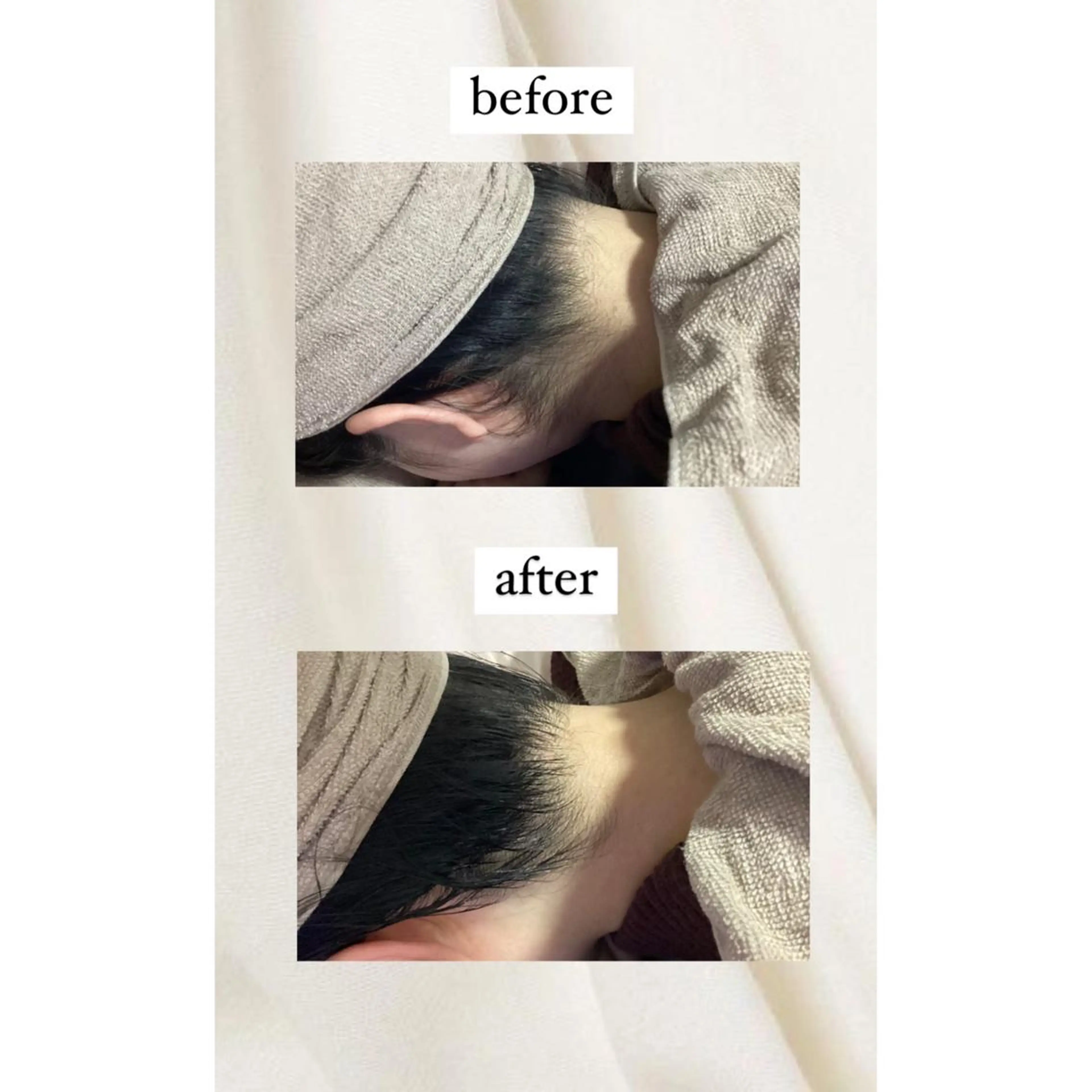 脱毛 crescent所属・【韓国肌管理・脱毛】 クレセントのエステ・リラクイメージ