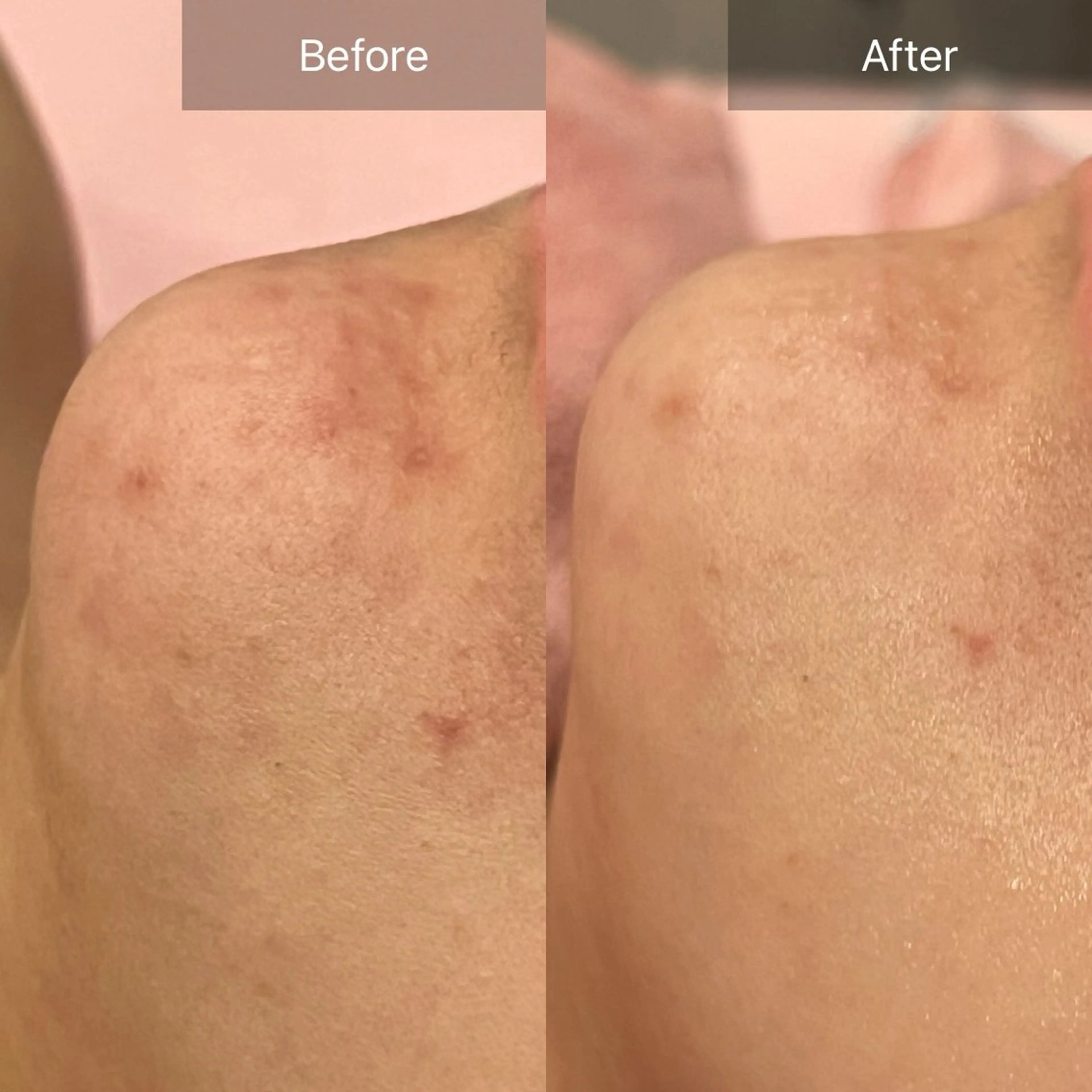 エステ リラク ルルアス GINZAのエステ・リラクイメージ