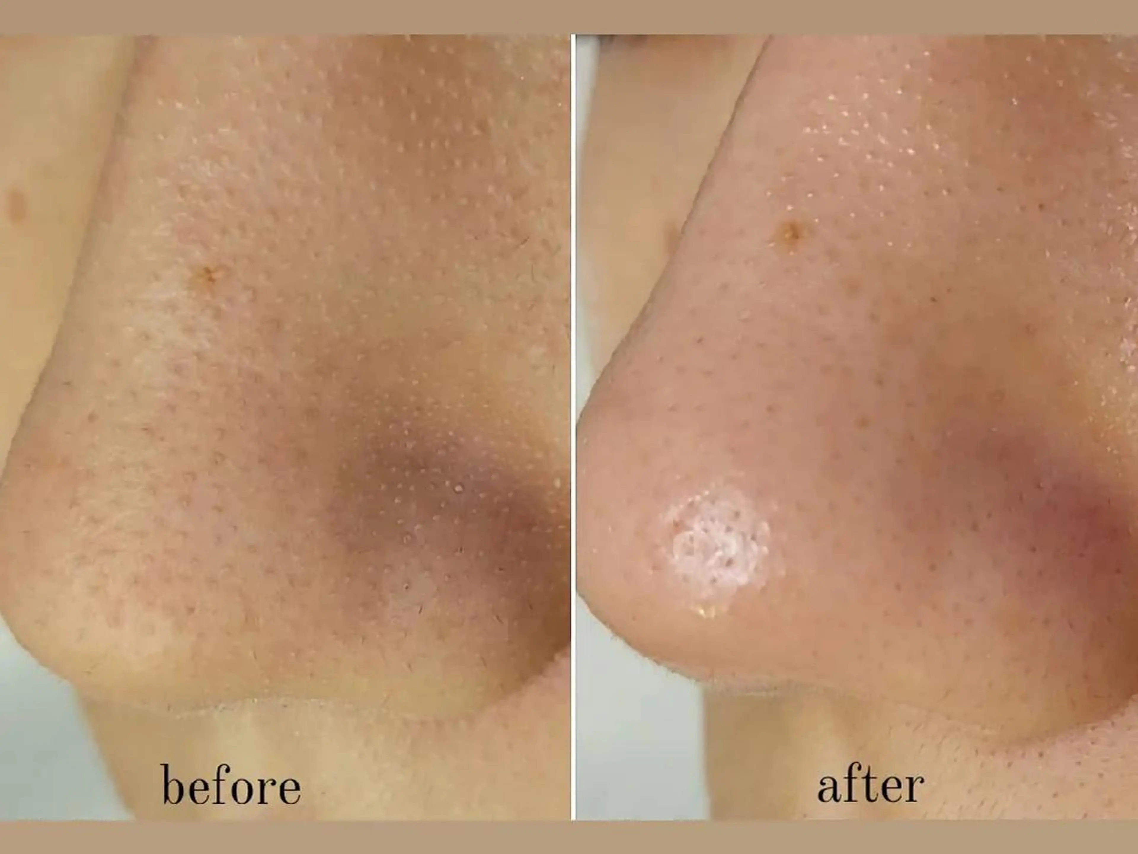 U_la所属・U_la [ウーラ] 片岡の眉毛・アイブロウイメージ