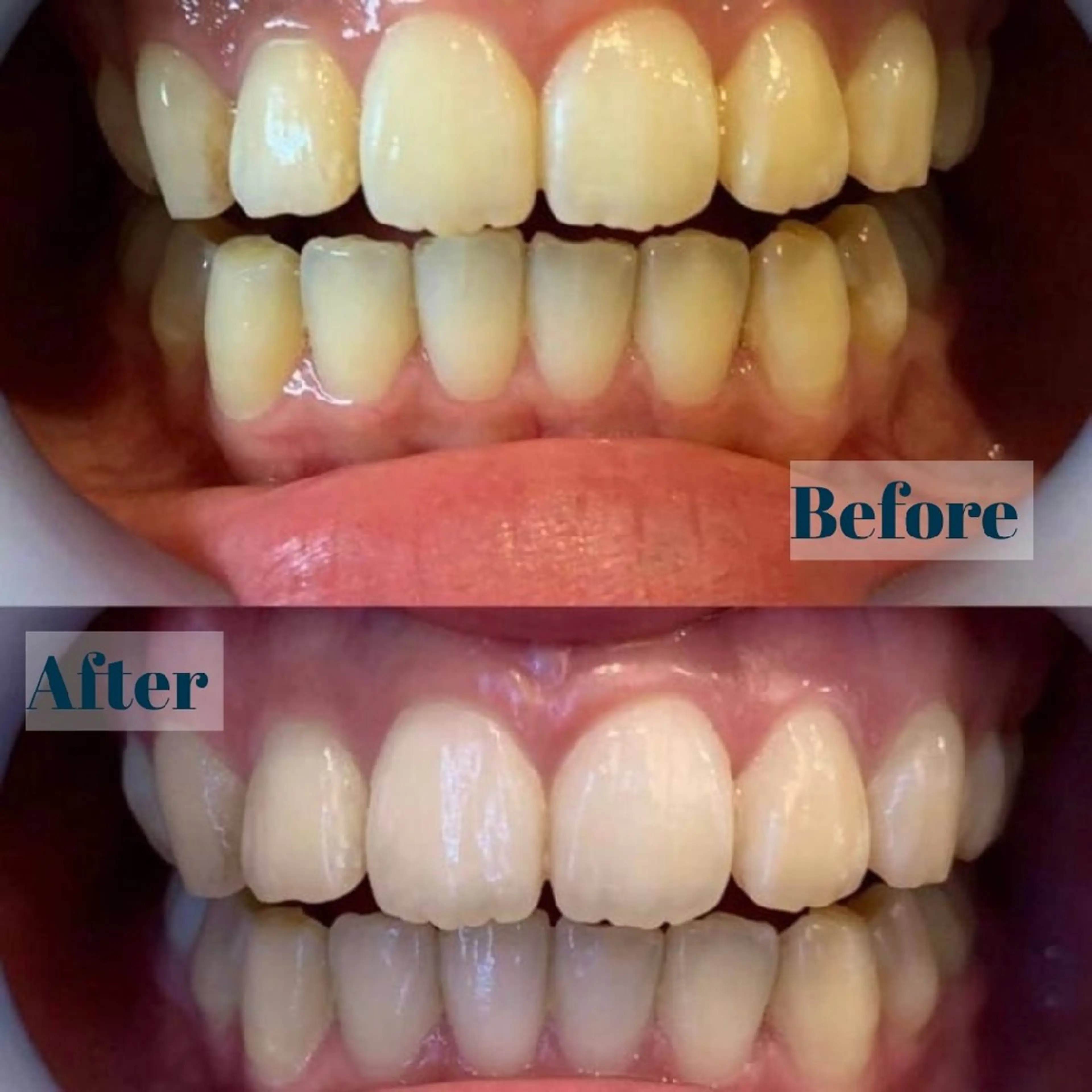 エステ リラク LBS吉祥寺 公式のエステ・リラクイメージ