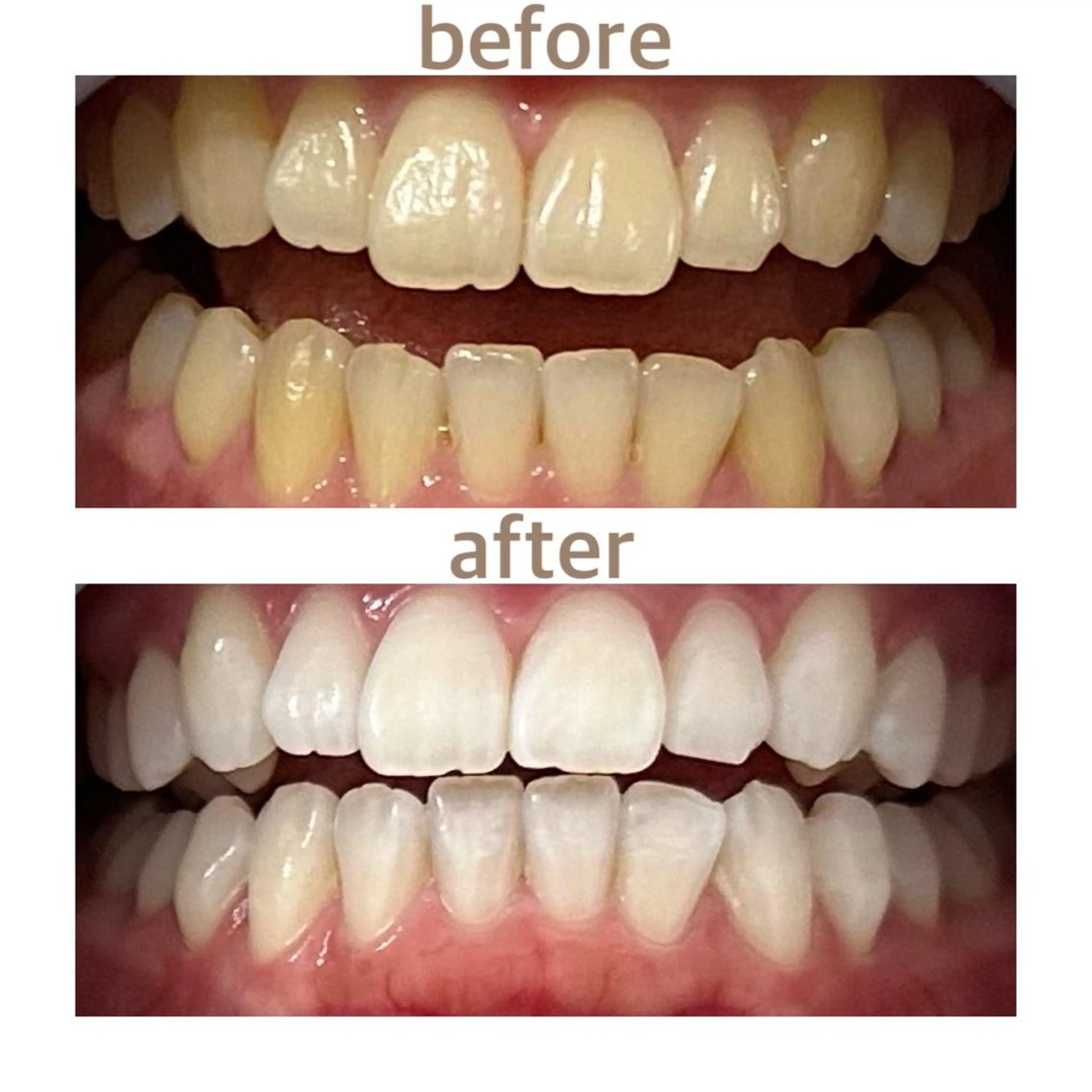 メンズ エステ リラク ホワイトニング ショップ船橋店のエステ・リラクイメージ