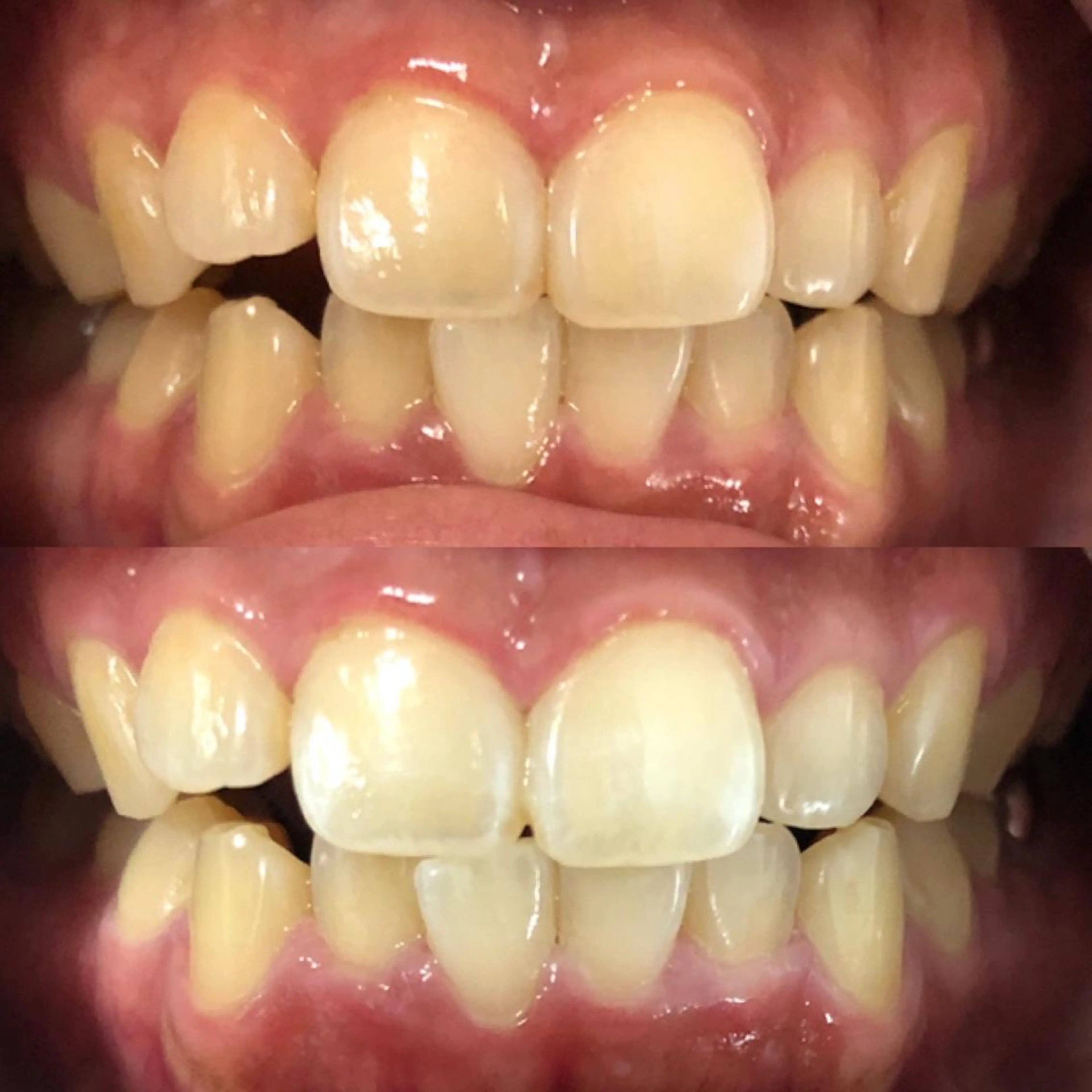 セミロング カラー パーマ ヘアアレンジ ネイル マツエク・マツパ アイブロウ LBSホワイトニング 🩵梅田店公式のエステ・リラクイメージ