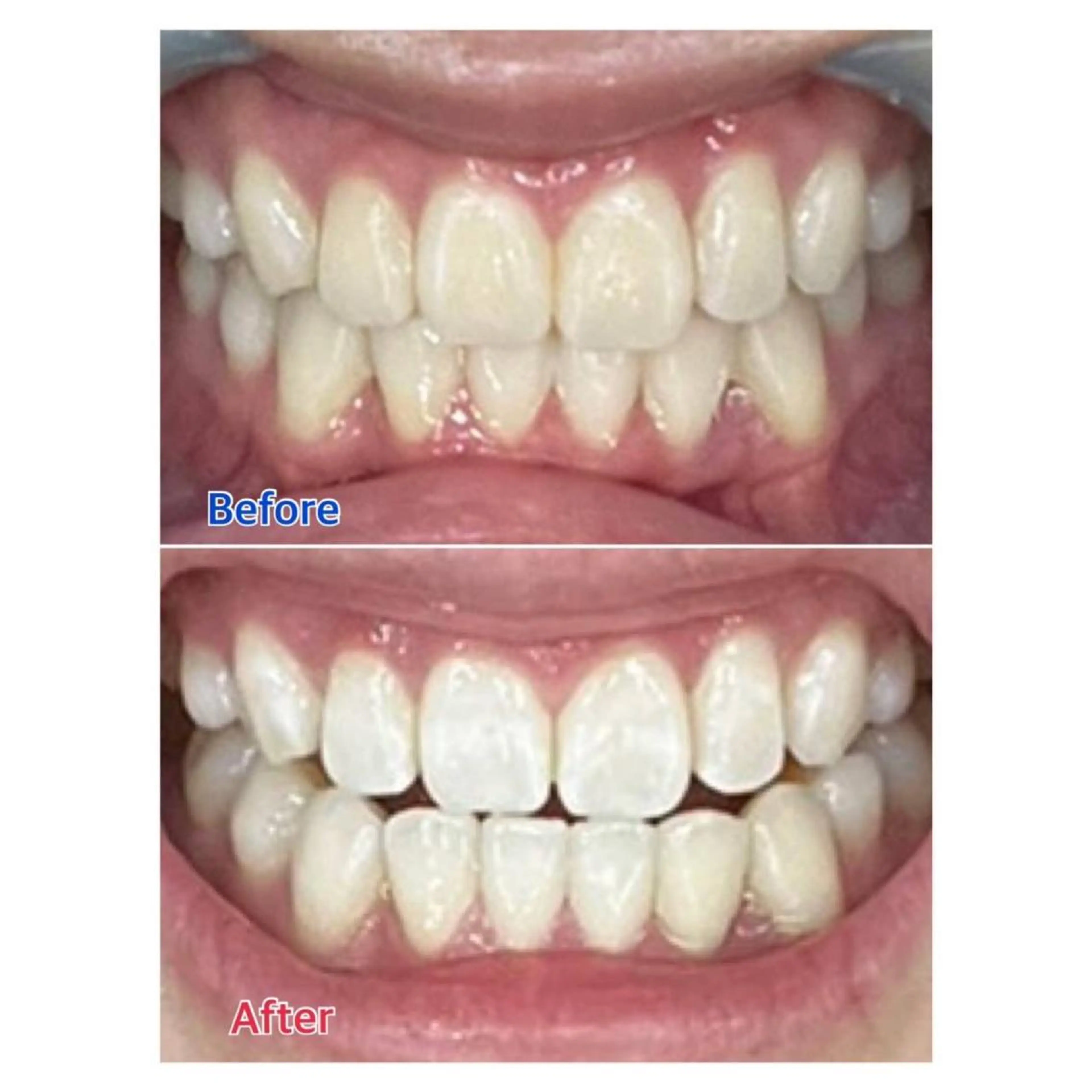 MBEAUTYSALON 千葉店・京成大久保所属・Melty 輝のその他イメージ