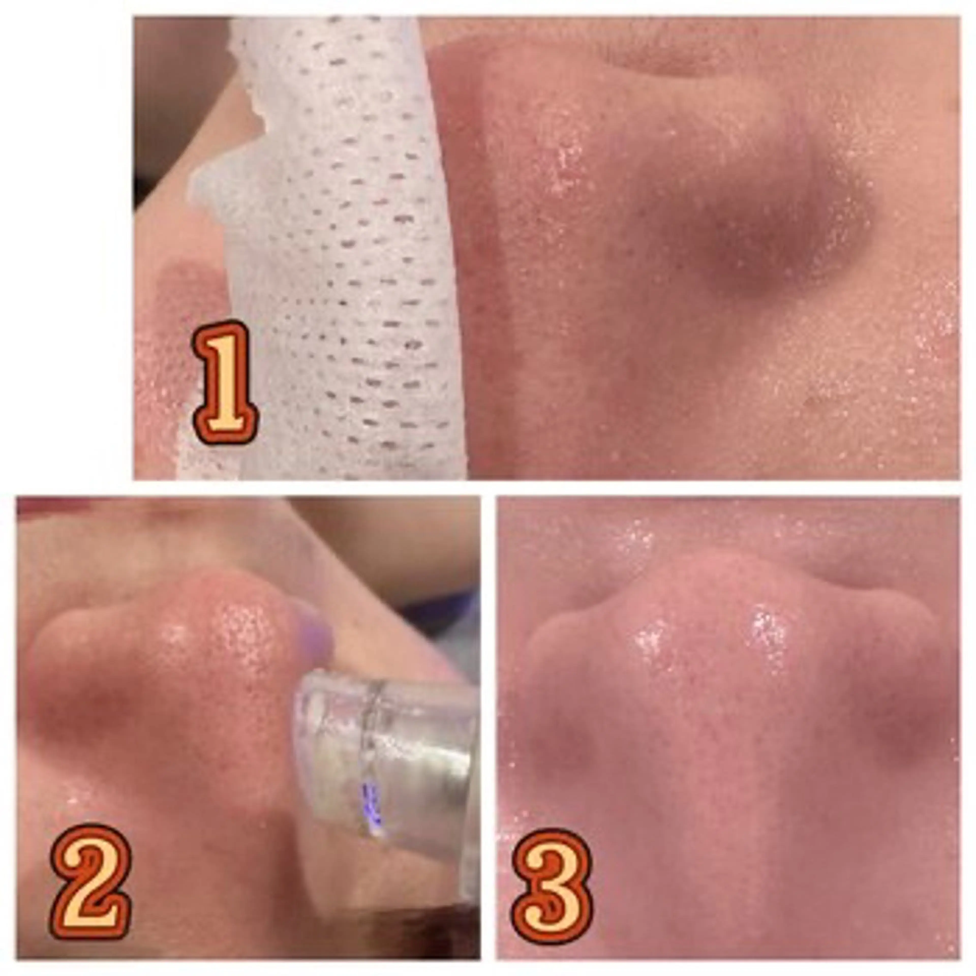 Amour所属・痩身・小顔・脱毛・ オイル&Amourのエステ・リラクイメージ