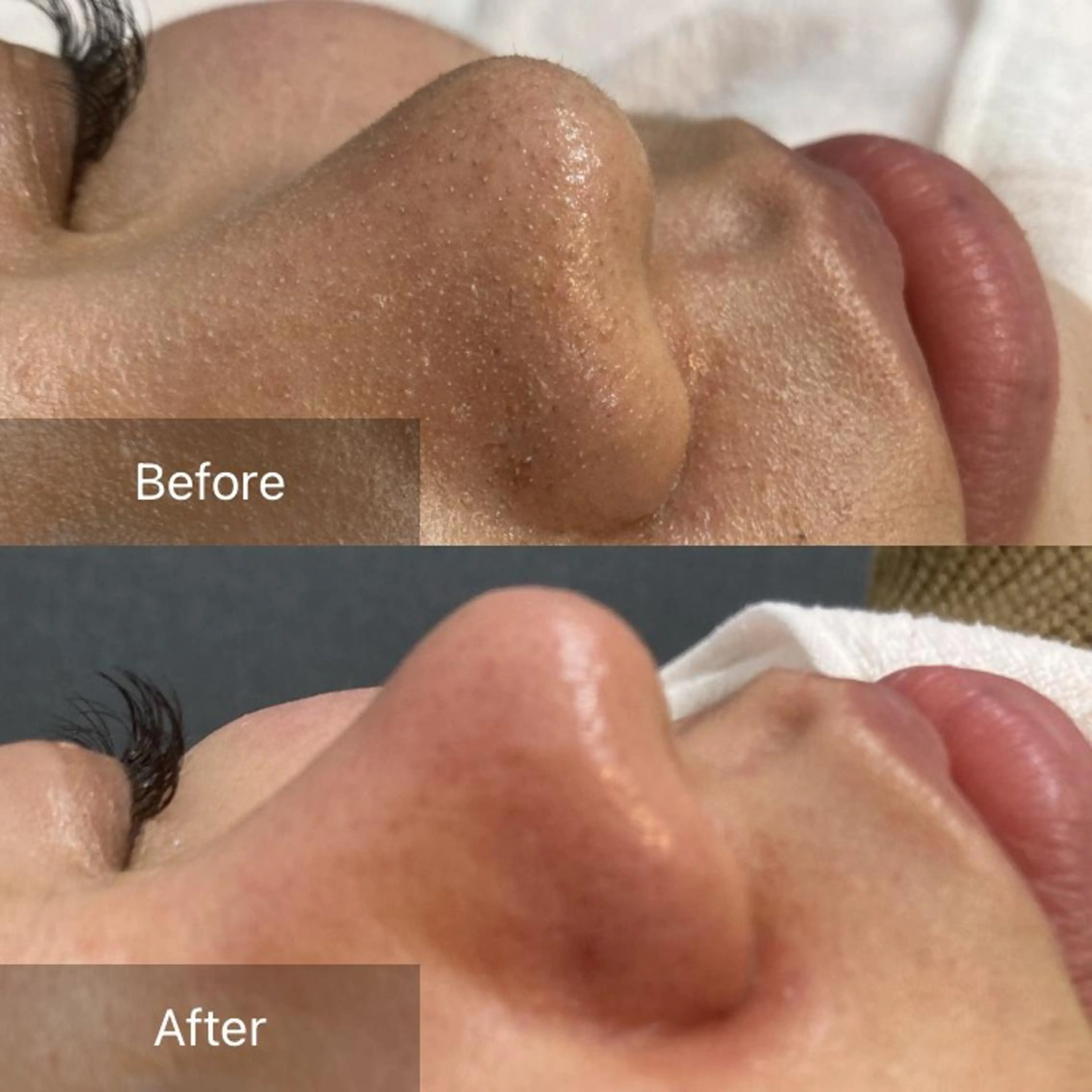 エステ リラク B&H所属・頭痛•肩こり専門/ 眉サロンB&H心斎橋のエステ・リラクイメージ