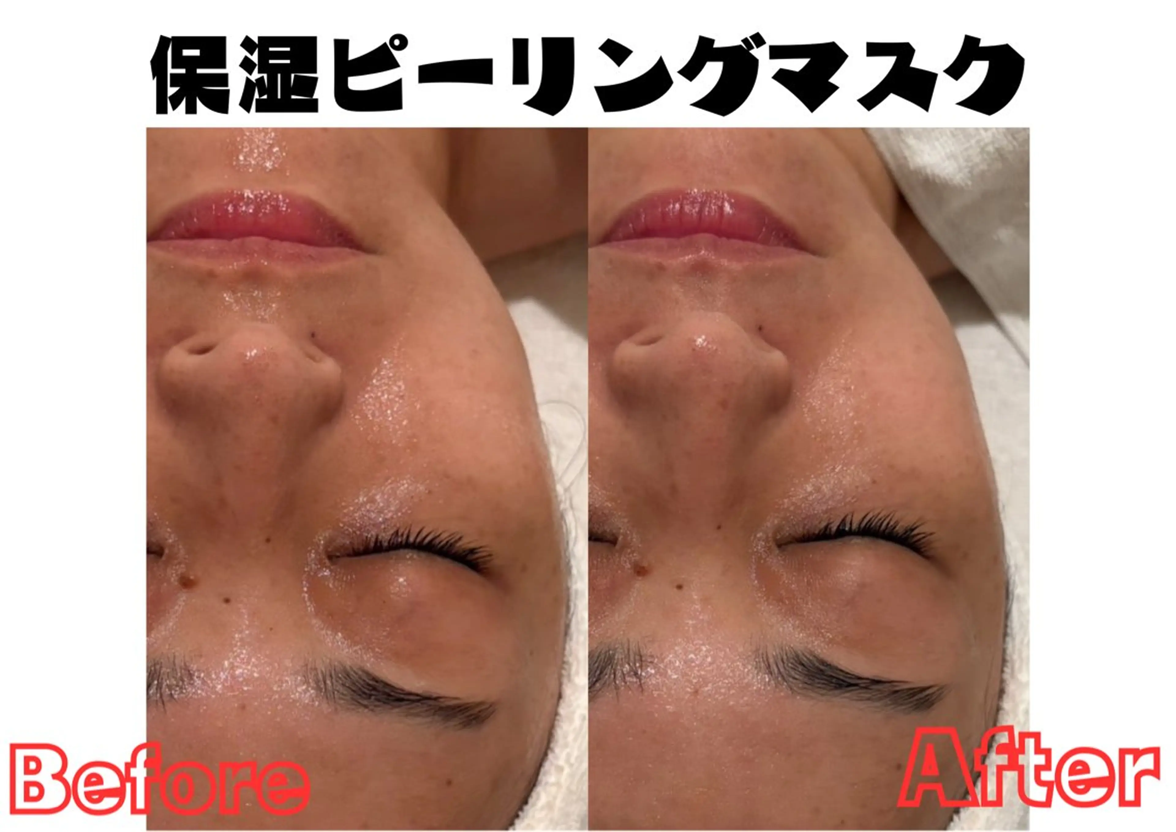 【保湿ピーリングマスク】の写真