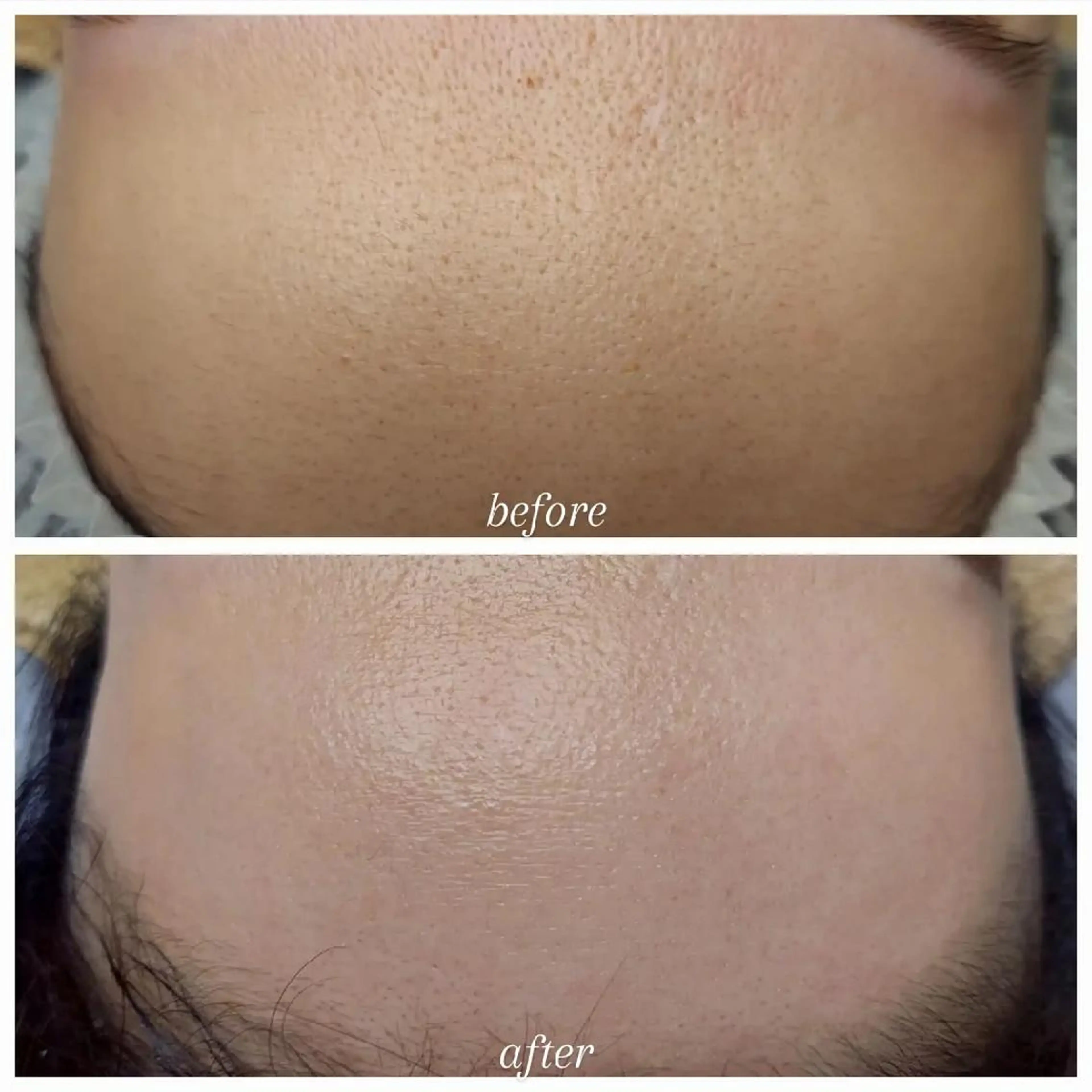 脱毛 U_la所属・U_la [ウーラ] 片岡の眉毛・アイブロウイメージ