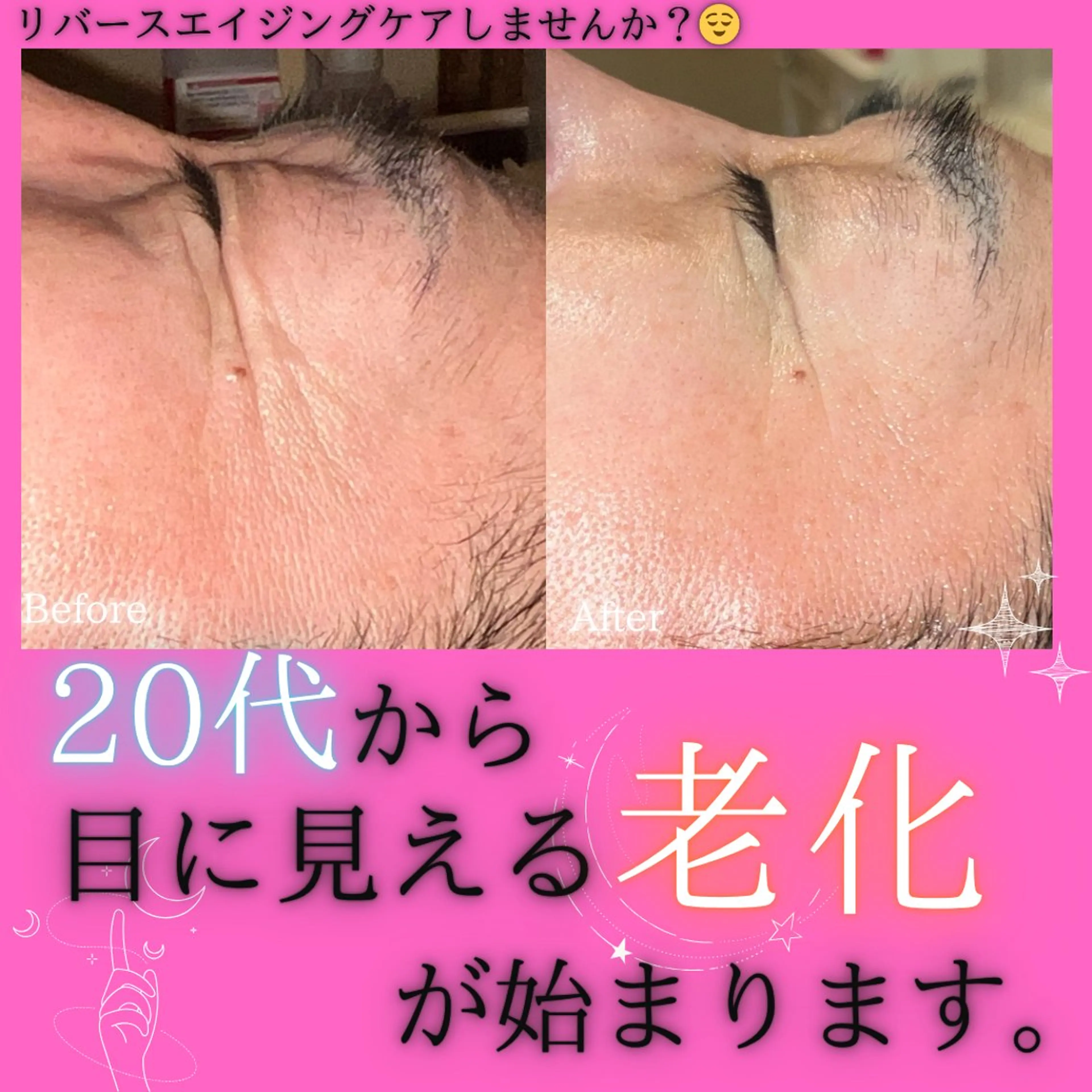 エステ リラク 痩身&美肌サロン 堀米✨のその他イメージ
