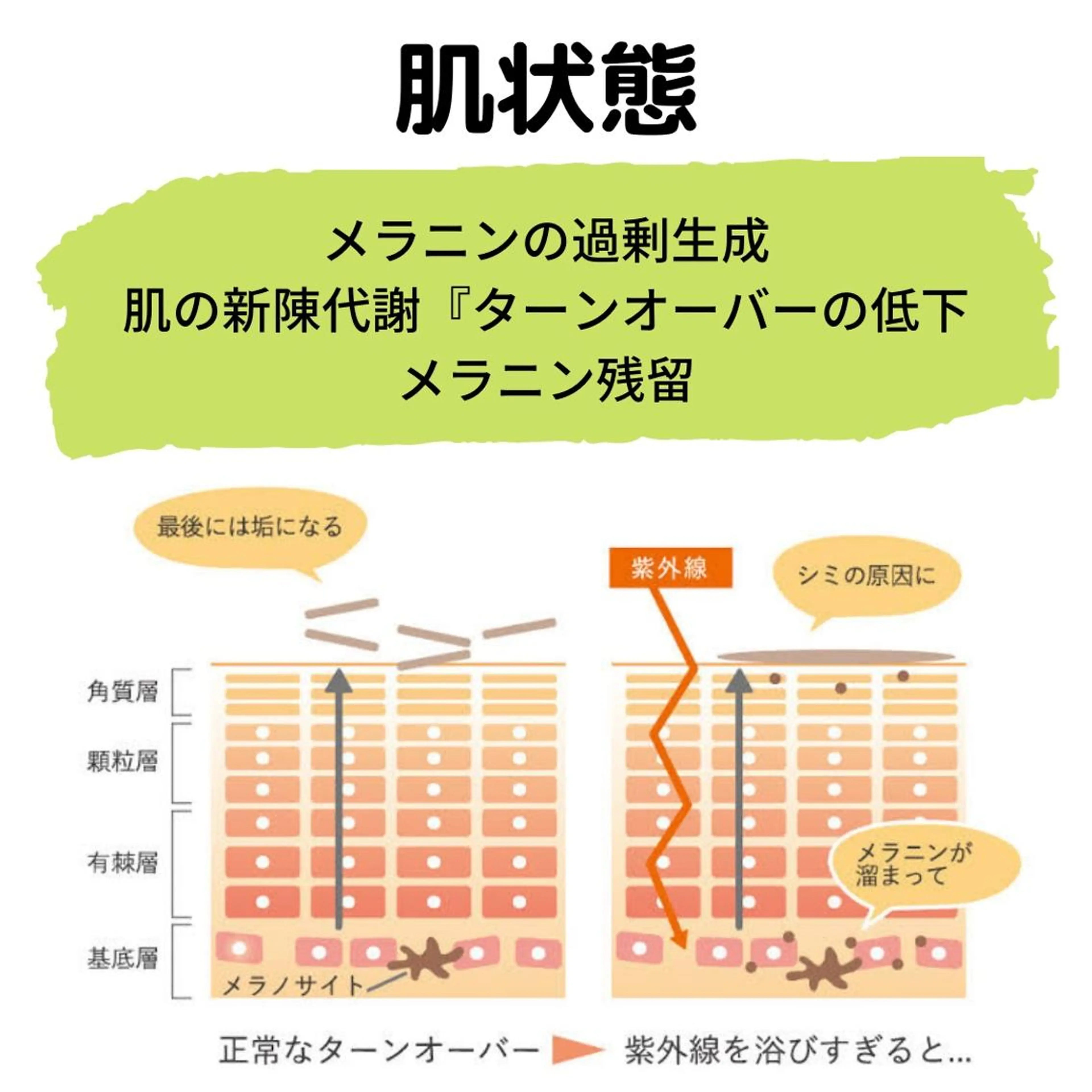 メンズ 20代から始める脱毛 salonLEPIAのエステ・リラクイメージ