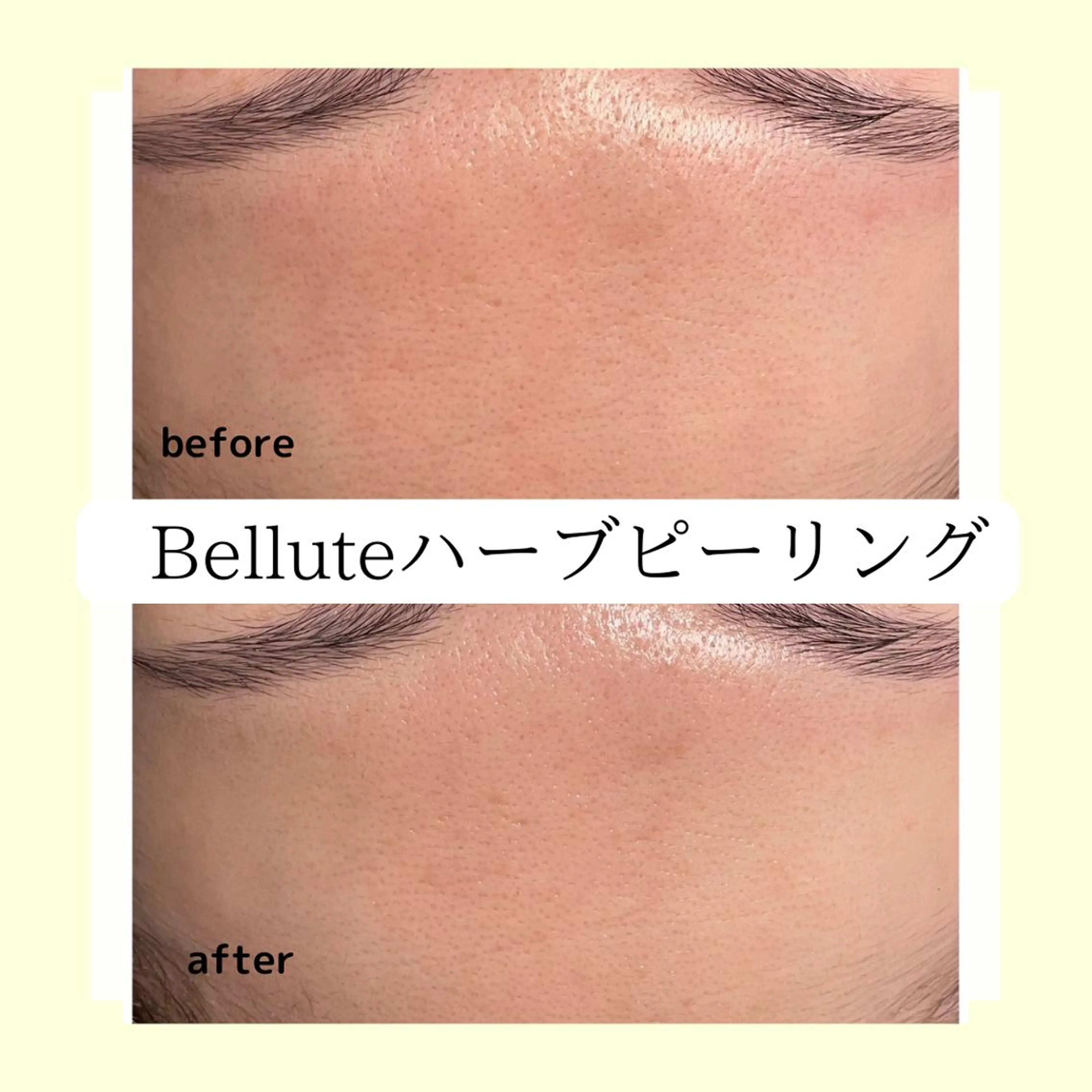 エステ リラク ピーリング専門店 Belluteのエステ・リラクイメージ