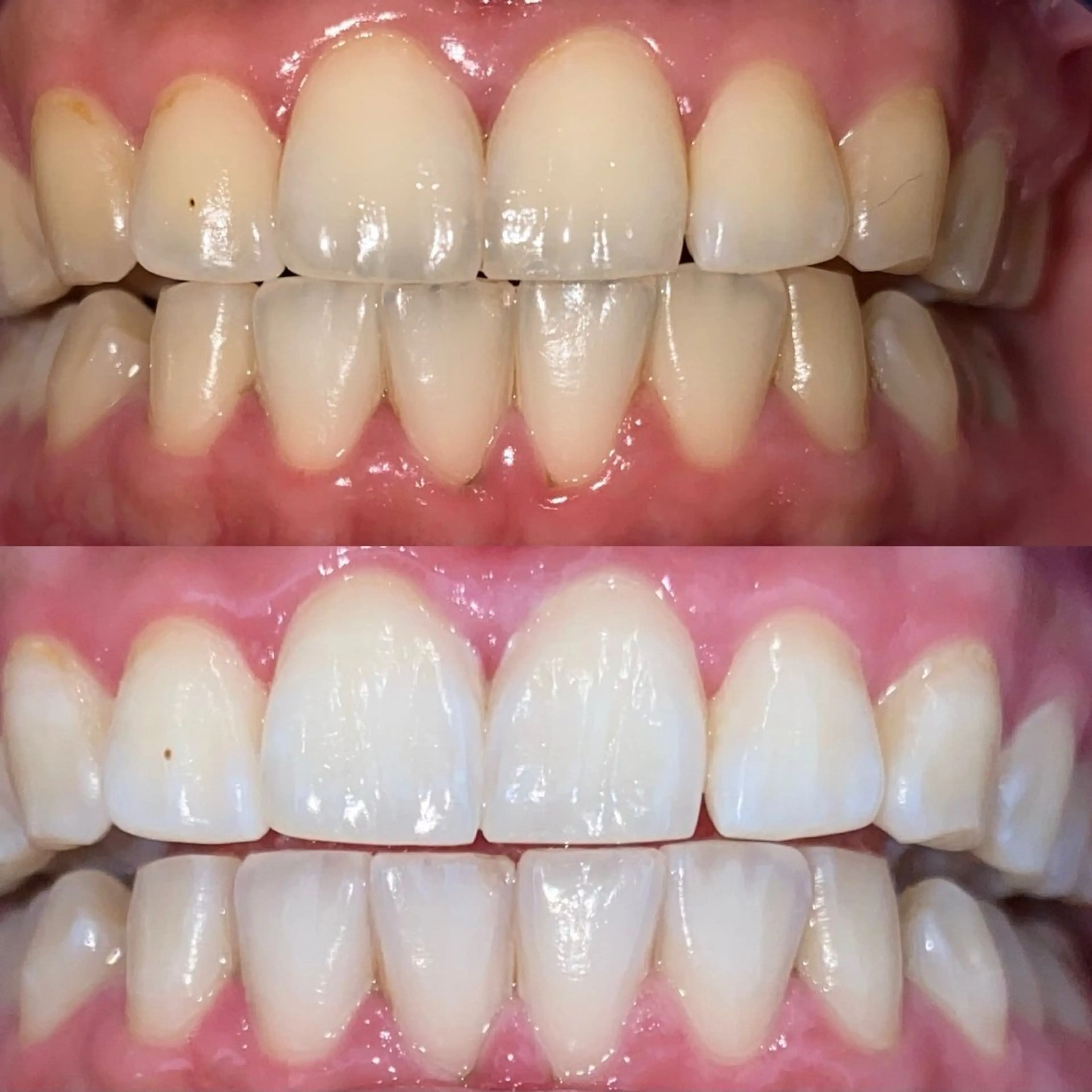 ホワイトニングサロンaile所属・セルフホワイトニング 金城しおりのその他イメージ