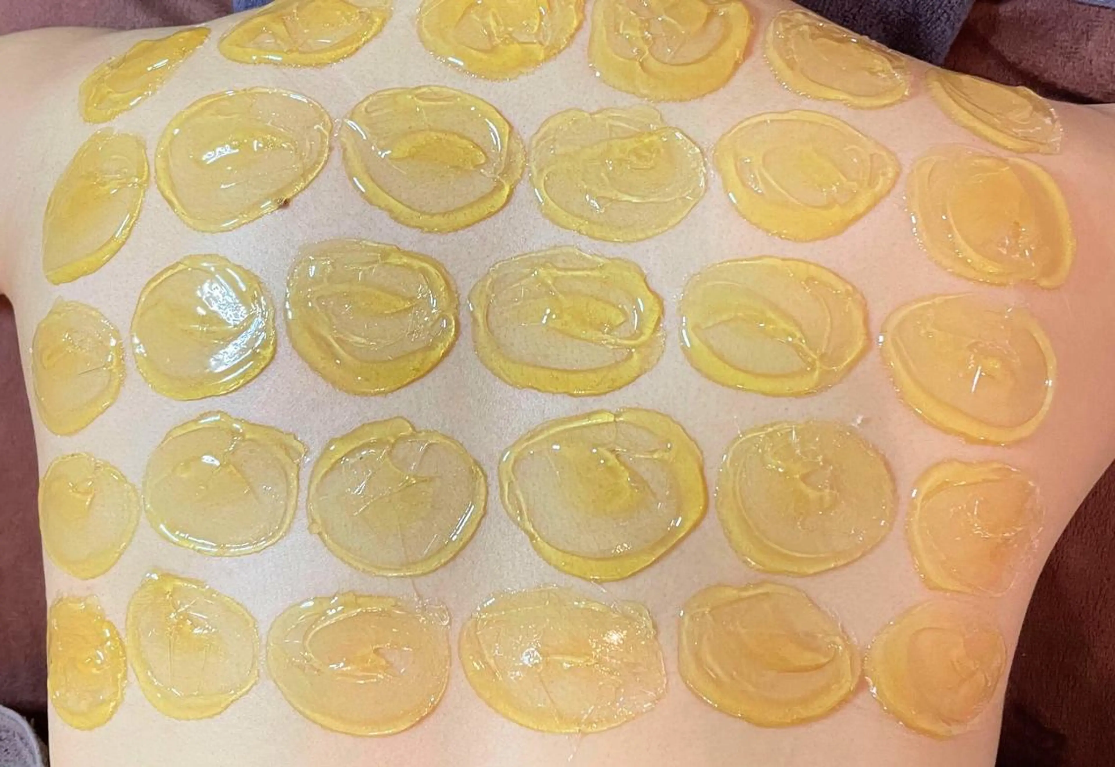 人気急上昇！毛穴汚れ＆産毛スッキリ！💙背中（上部）松やにWAX！８８００円💙ツルツル背中へ！男性の方にも人気！の写真