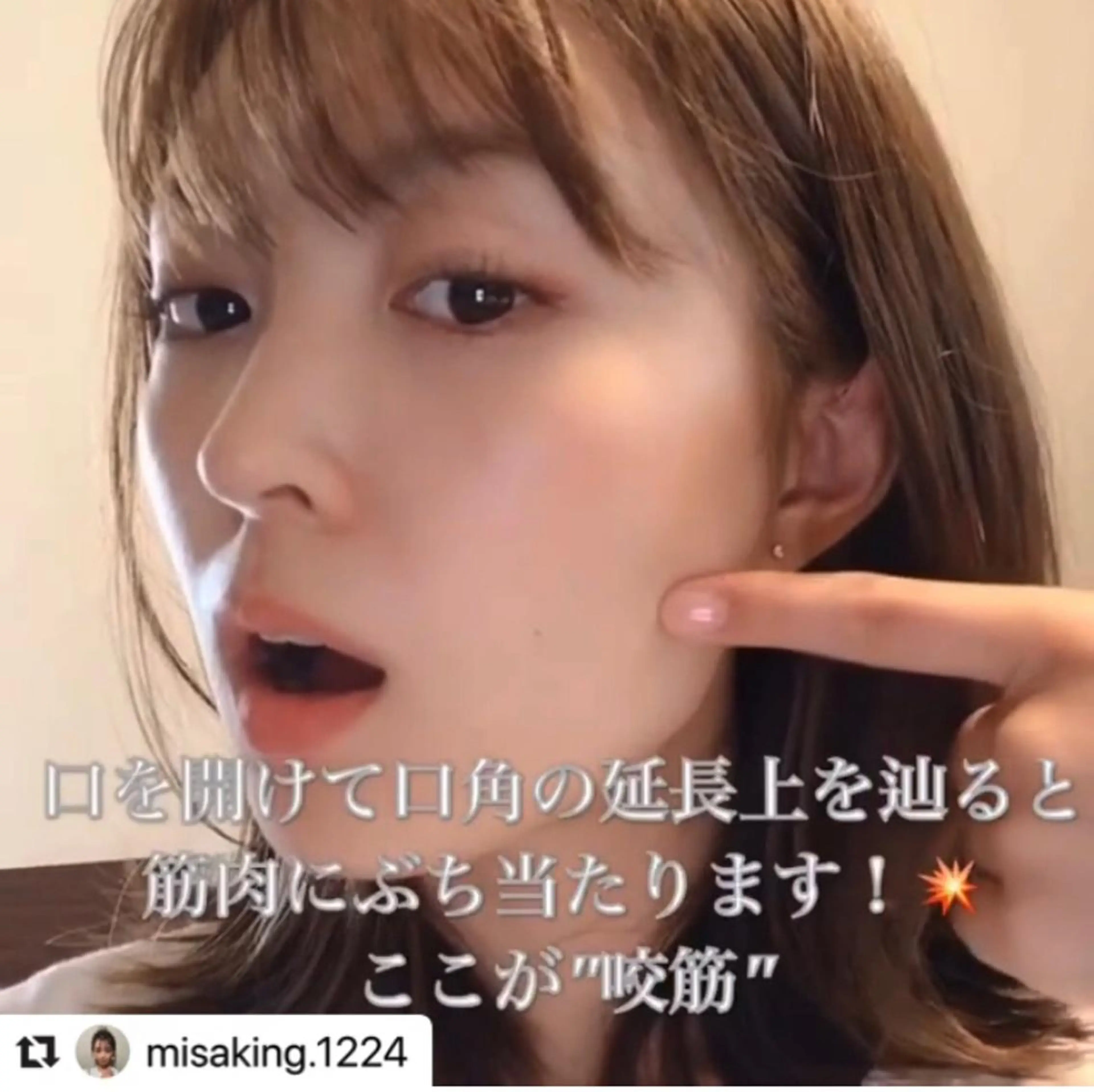 鍼灸整骨院Refine所属・鍼灸 Refineのその他イメージ