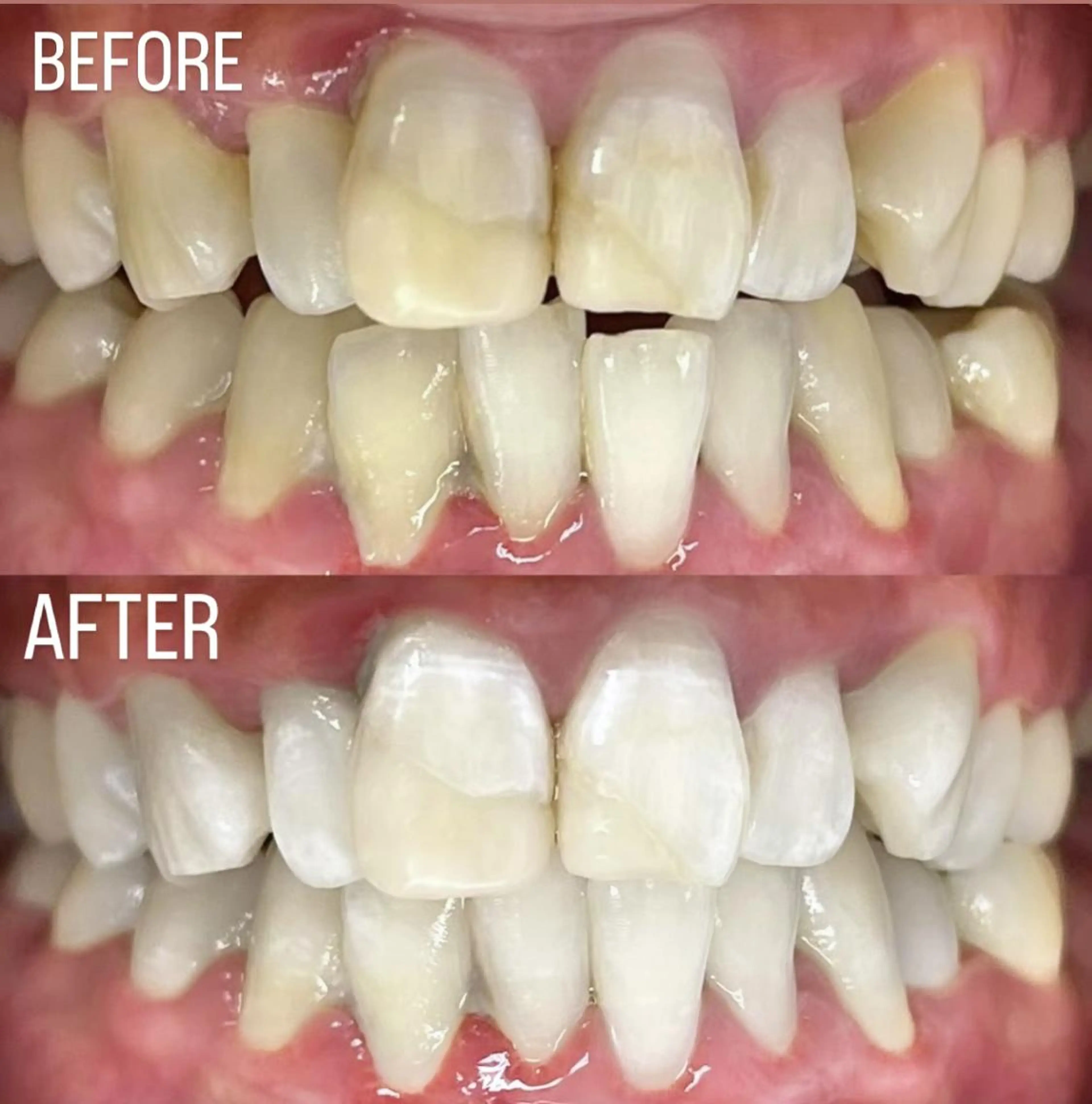 LBSホワイトニング 銀座店💎店長浦和のその他イメージ