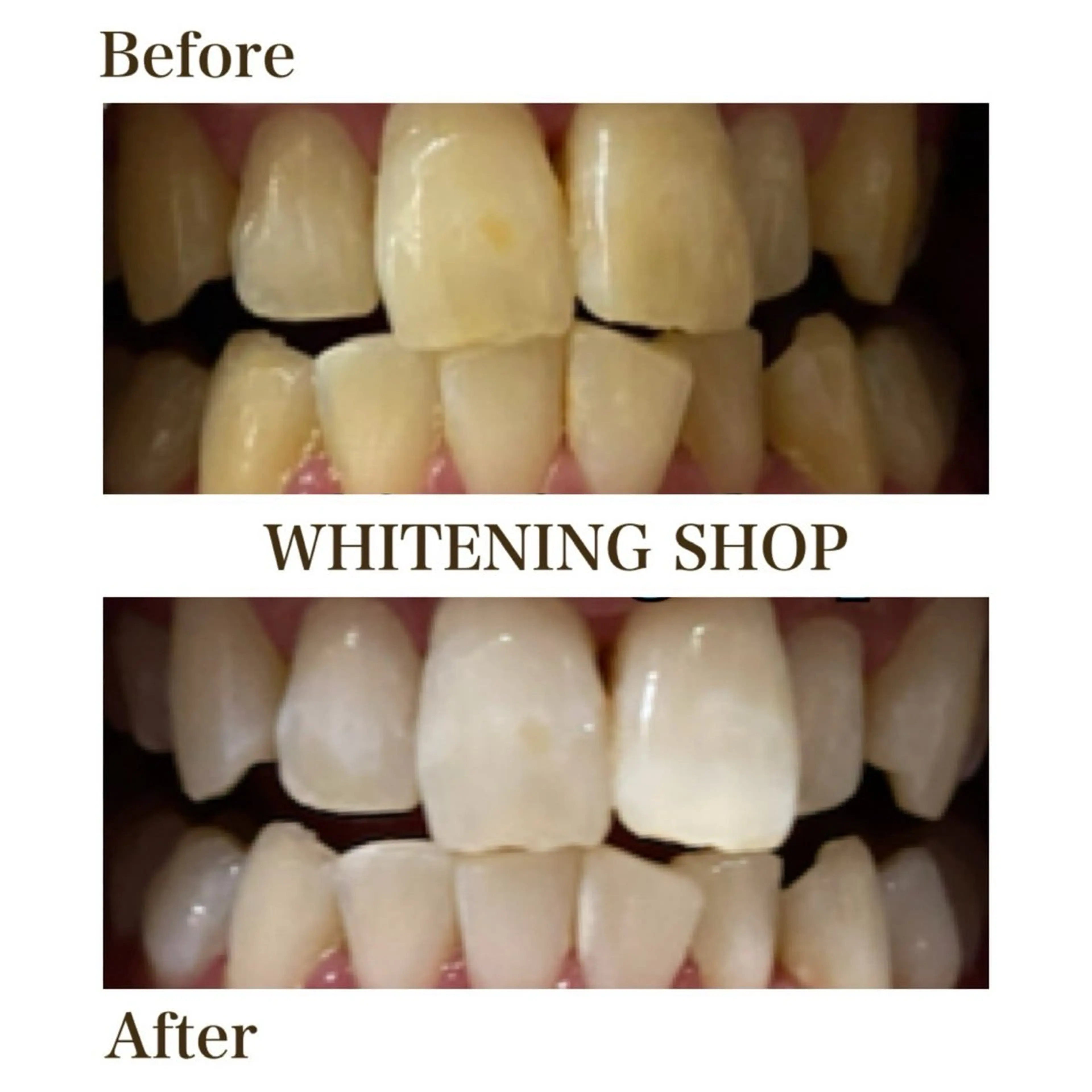 その他 セルフホワイトニングショップ静岡葵区店所属・もえか静岡葵区店ホ ワイトニングショップのその他イメージ