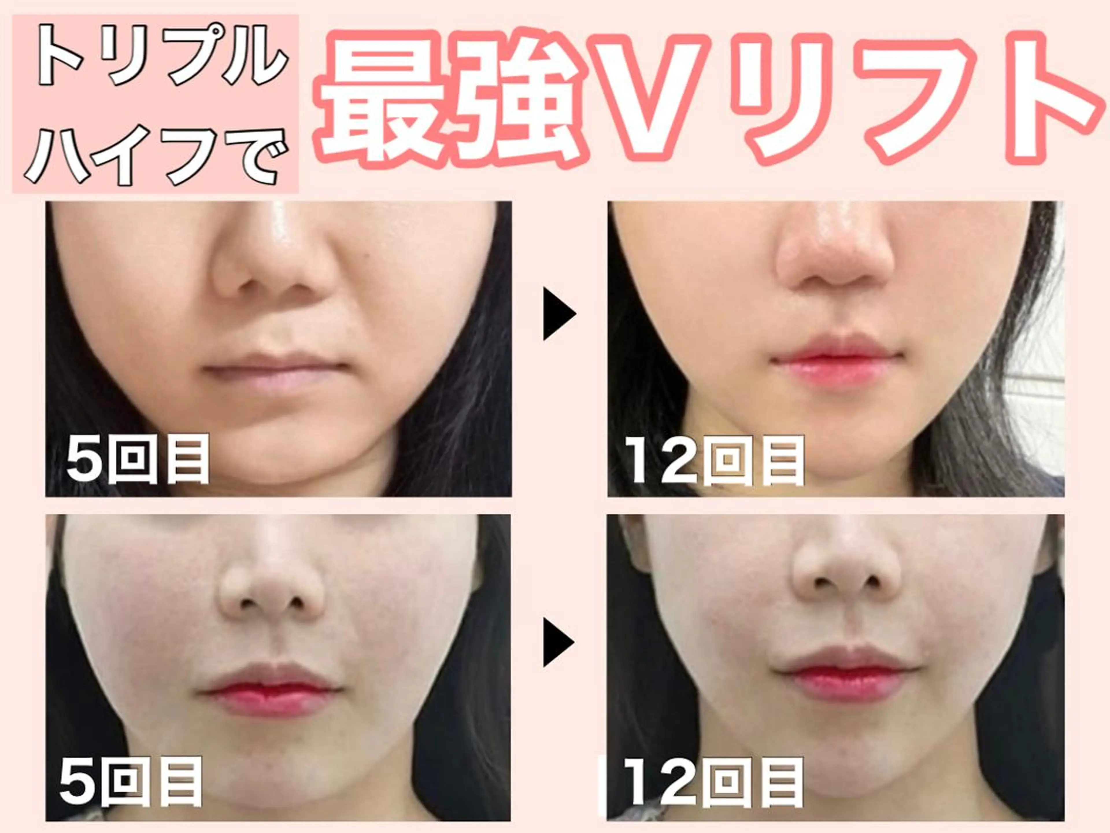 ■超絶小顔＆肌管理室■所属・🦋整形級の究極美顔 本格韓国式小顔🦋のエステ・リラクイメージ
