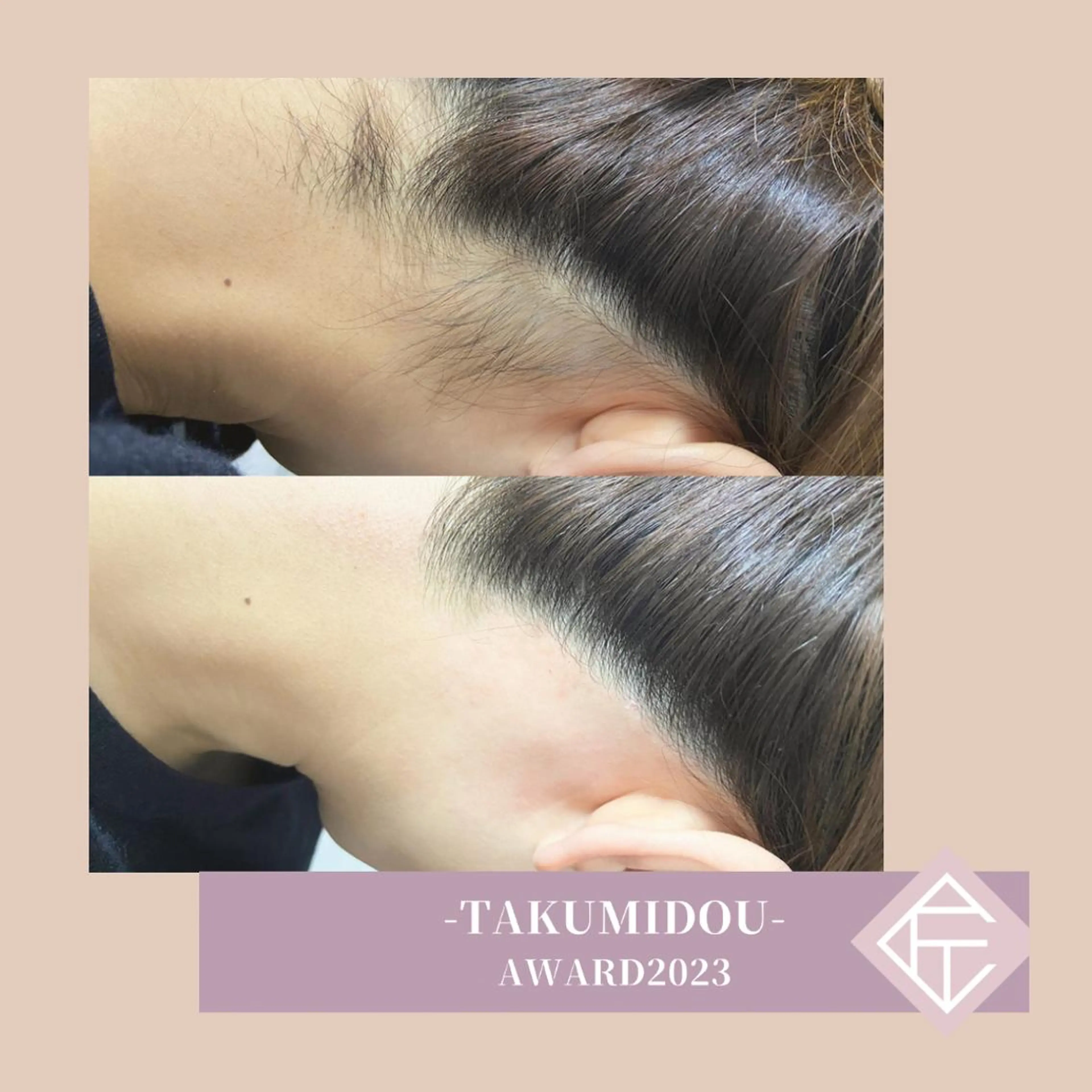 脱毛 &me ayakaのエステ・リラクイメージ