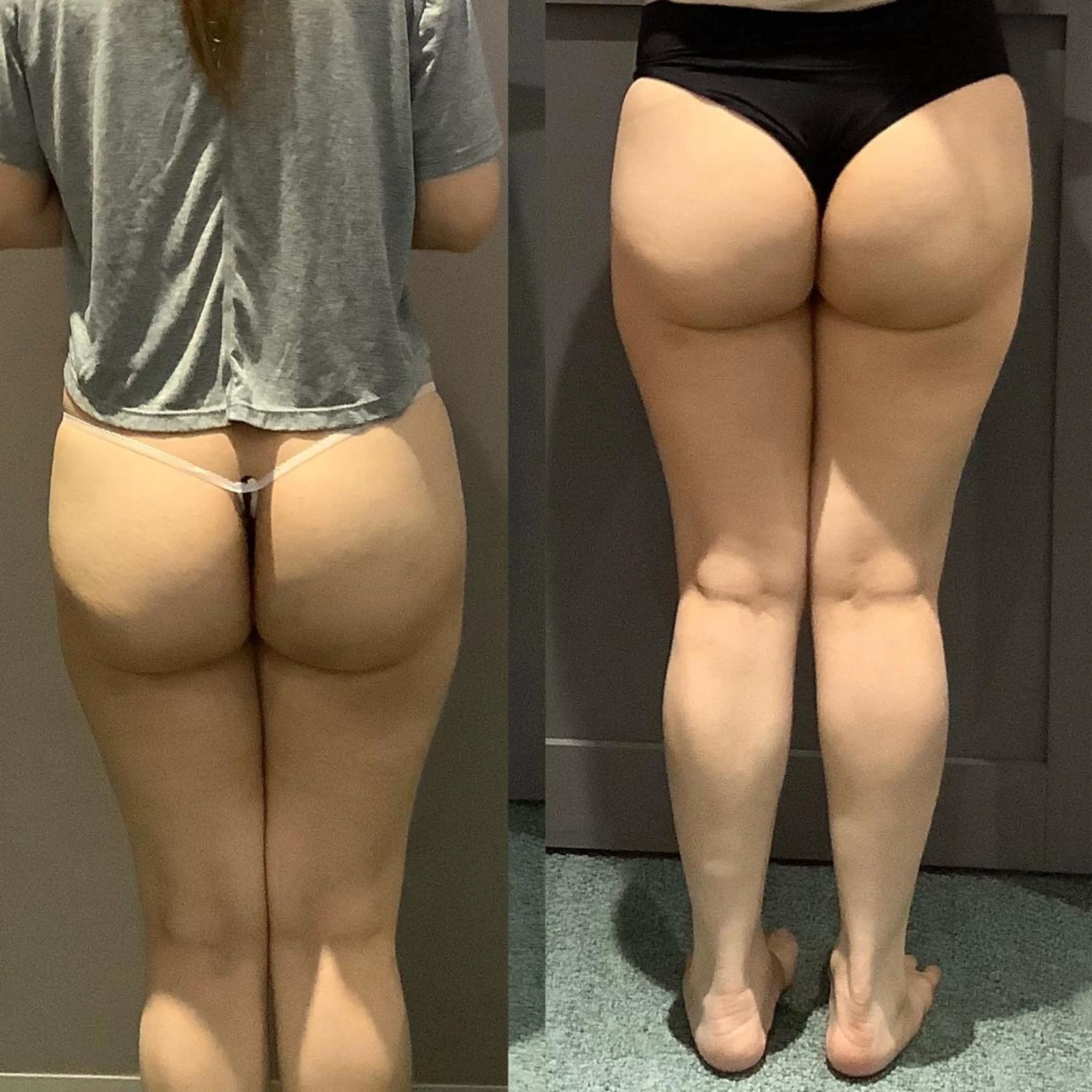 embellie アンベリー所属・アン ベリーのエステ・リラクイメージ