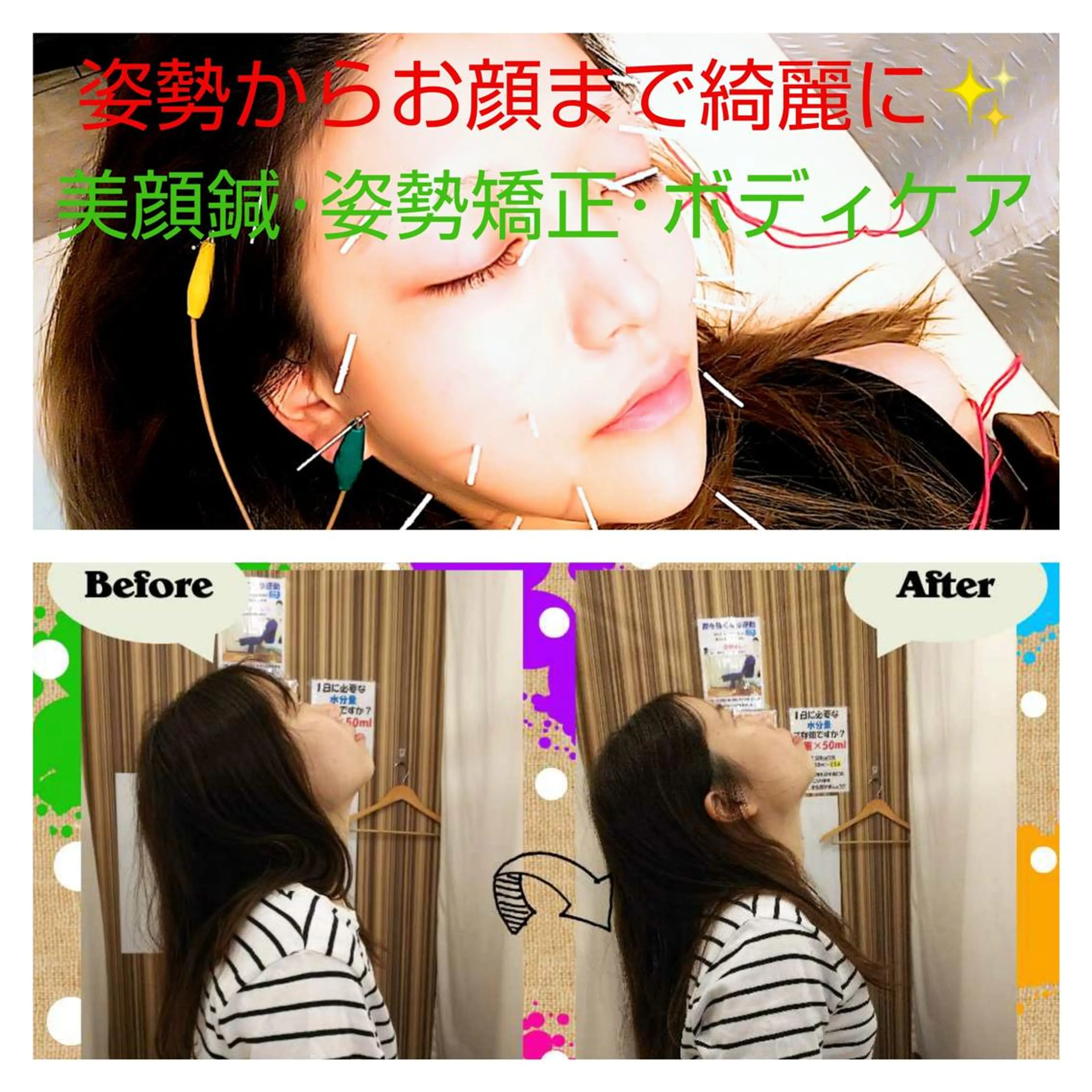 むくみたるみ専門☆ 美容鍼・小顔矯正のエステ・リラクイメージ