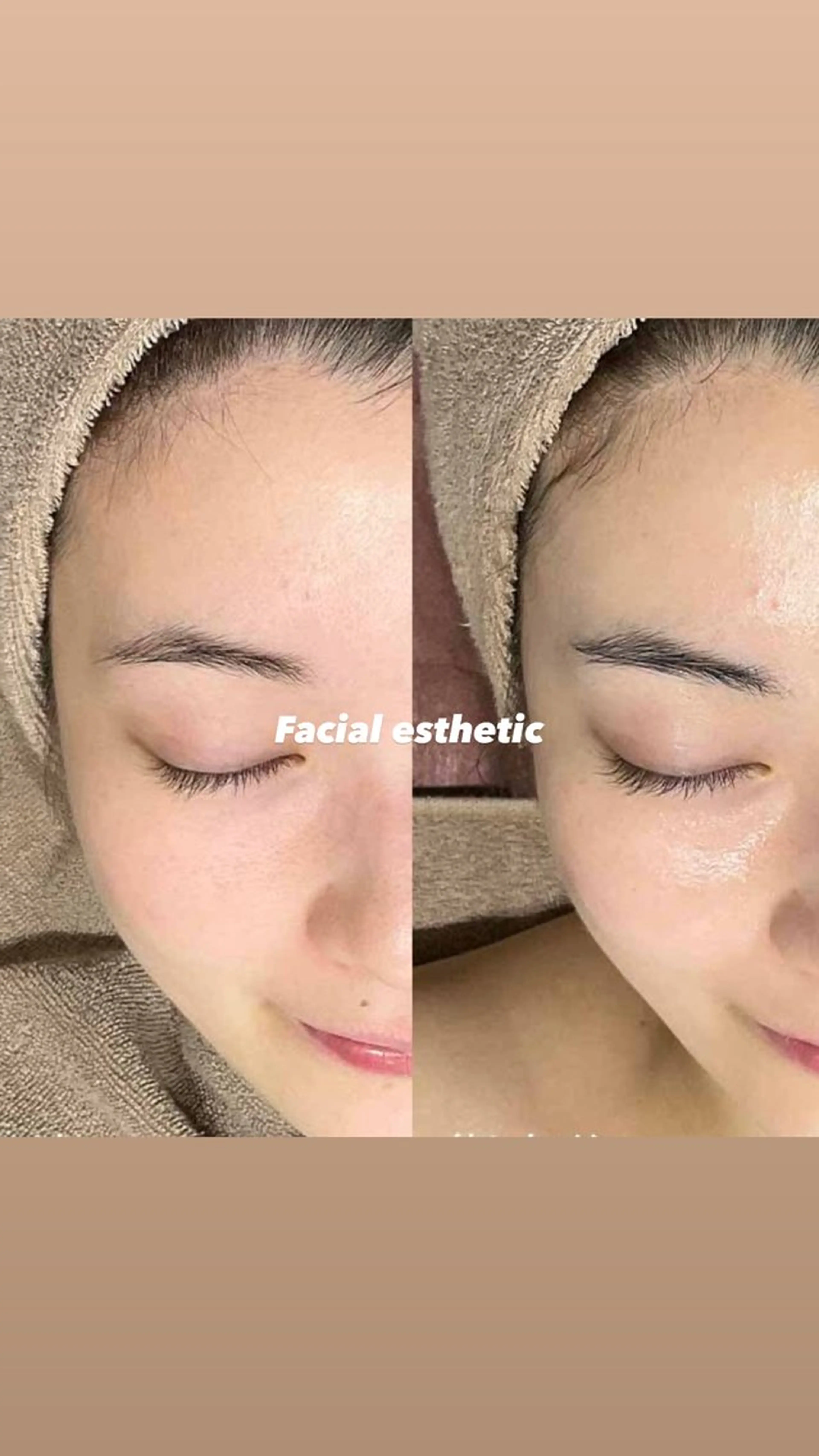 🎀Fuse / non🎀のヘアスタイル