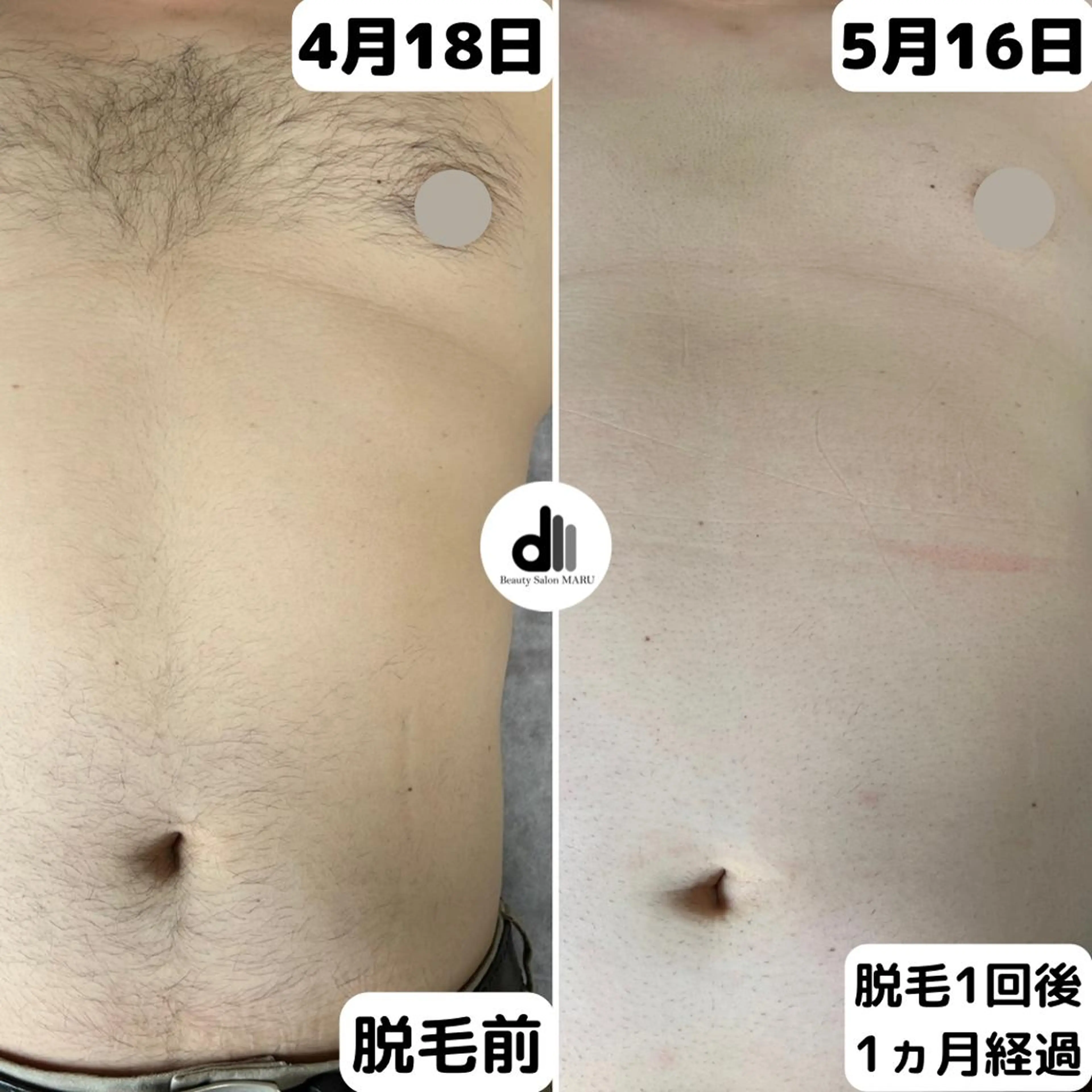 メンズ Beauty Salon MARU所属・新潟市メンズ【脱毛】 MARUのエステ・リラクイメージ