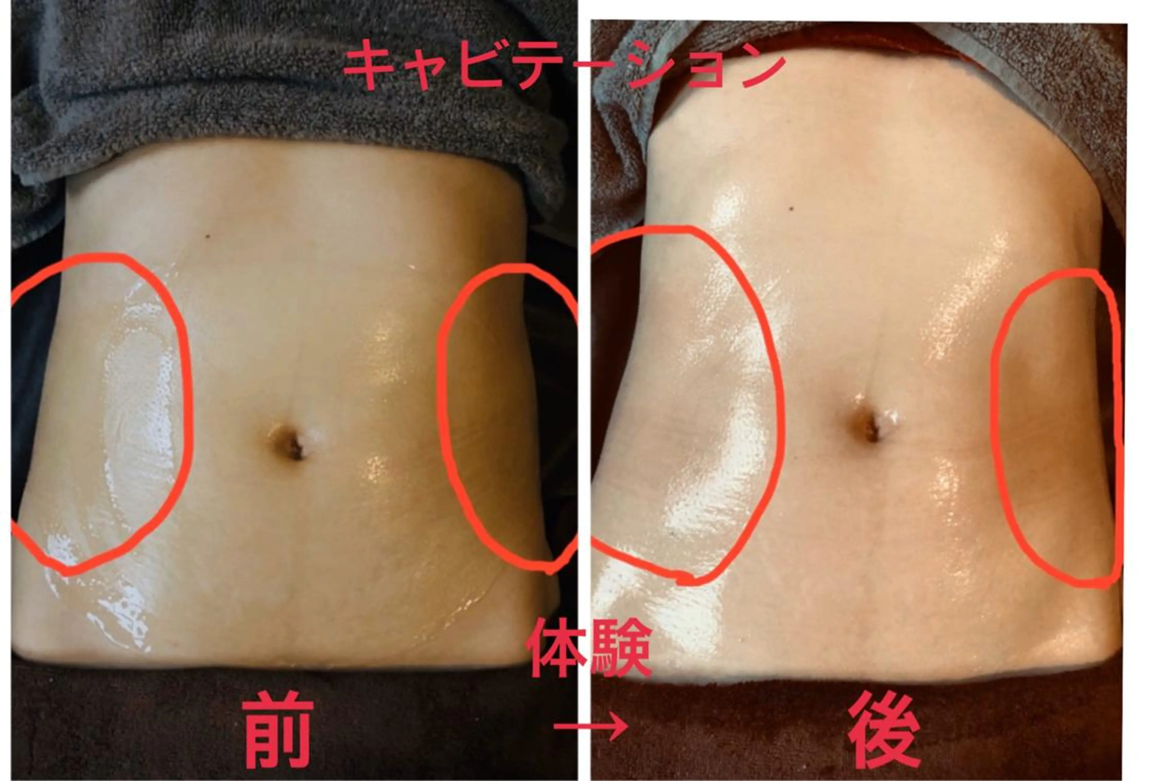 Beauty Salon Mirei所属・Beauty SalonMireiのエステ・リラクイメージ