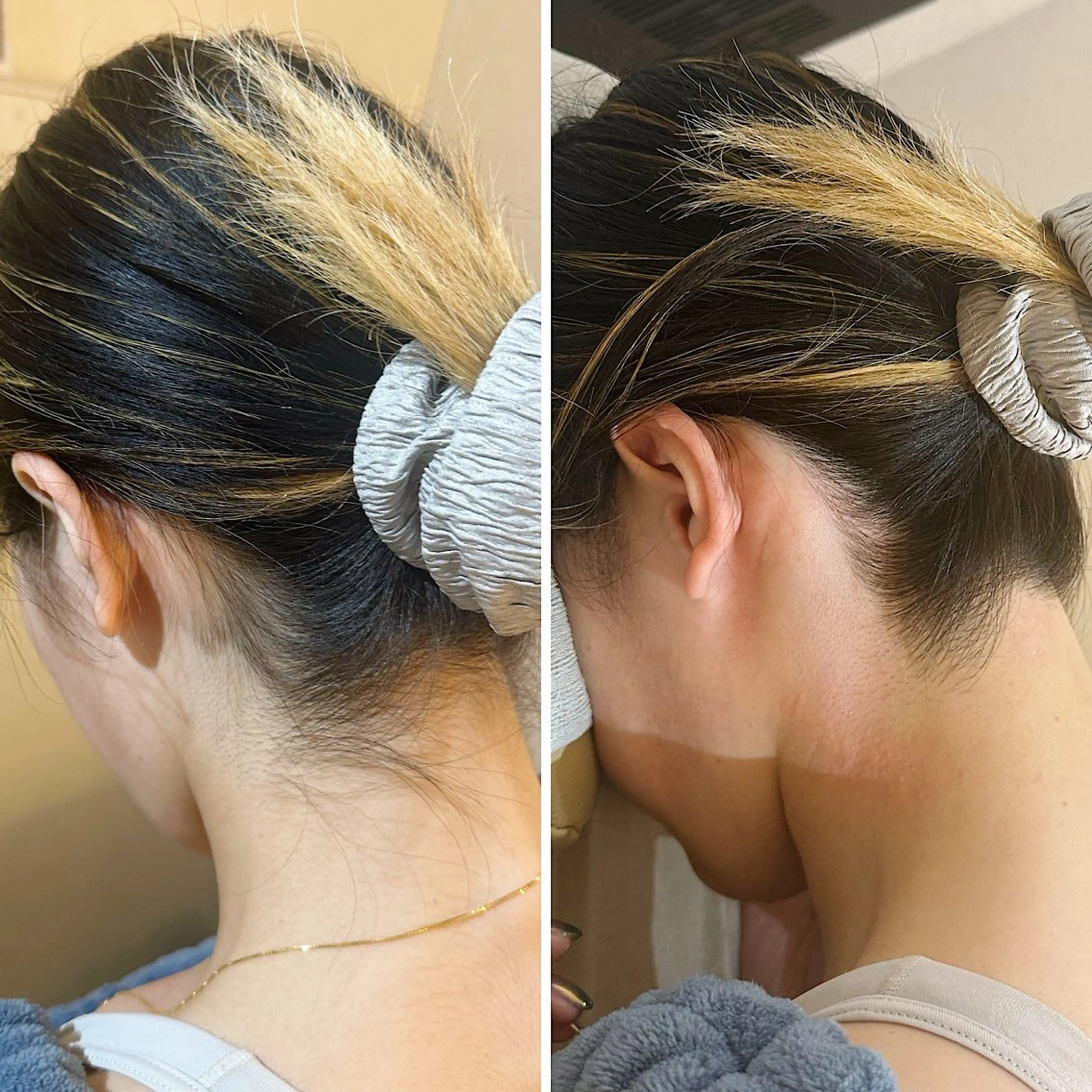 脱毛 うなじ脱毛/美肌脱毛 LABELのエステ・リラクイメージ