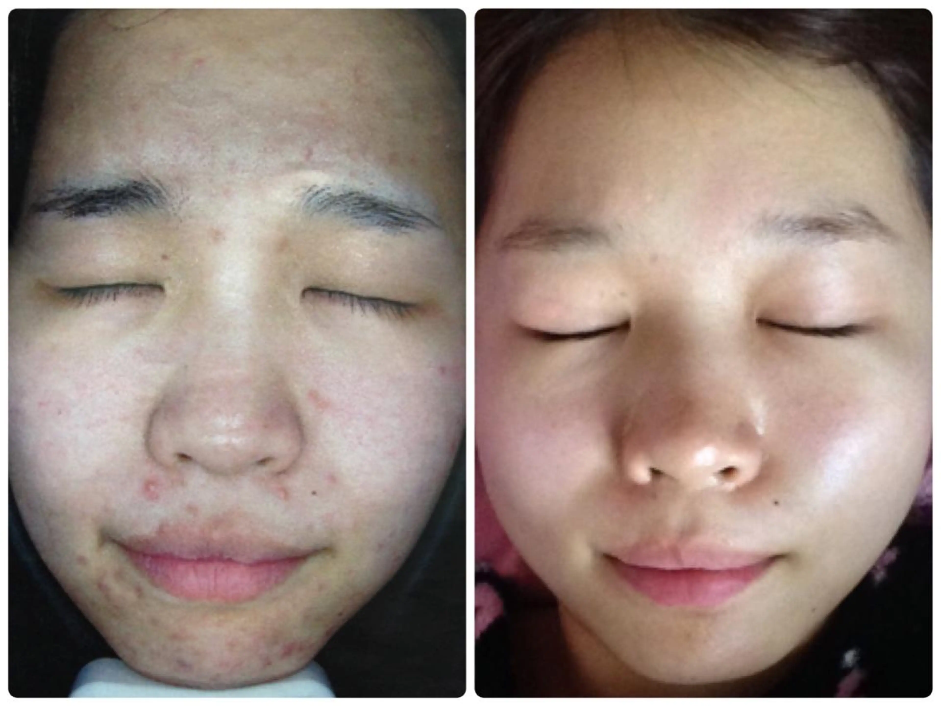 都度払い肌質改善 &脱毛Blancheのエステ・リラクイメージ