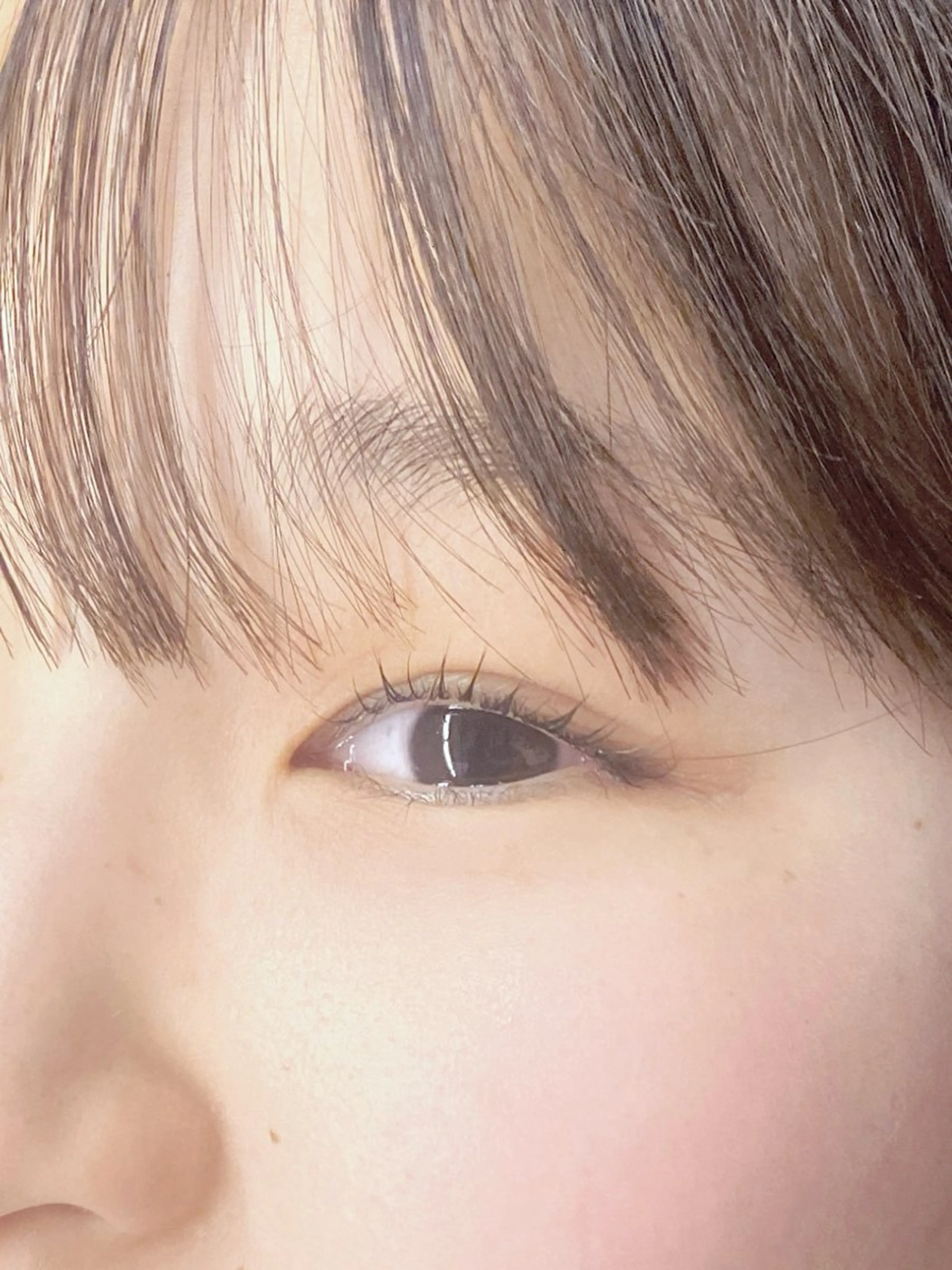モンテラッシュリフトの写真