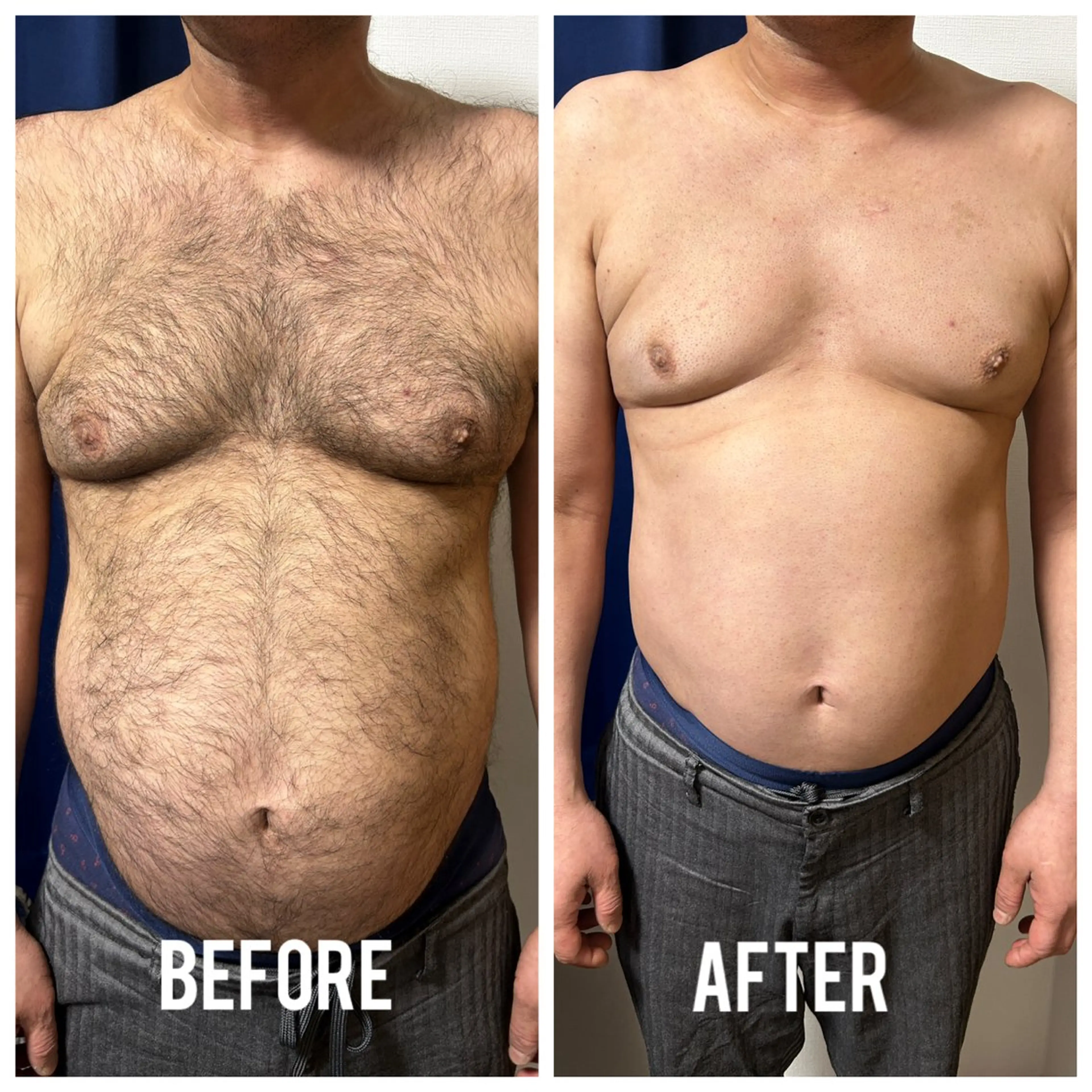 メンズ 脱毛 メンズ脱毛サロン shavys所属・shavys せいじのエステ・リラクイメージ