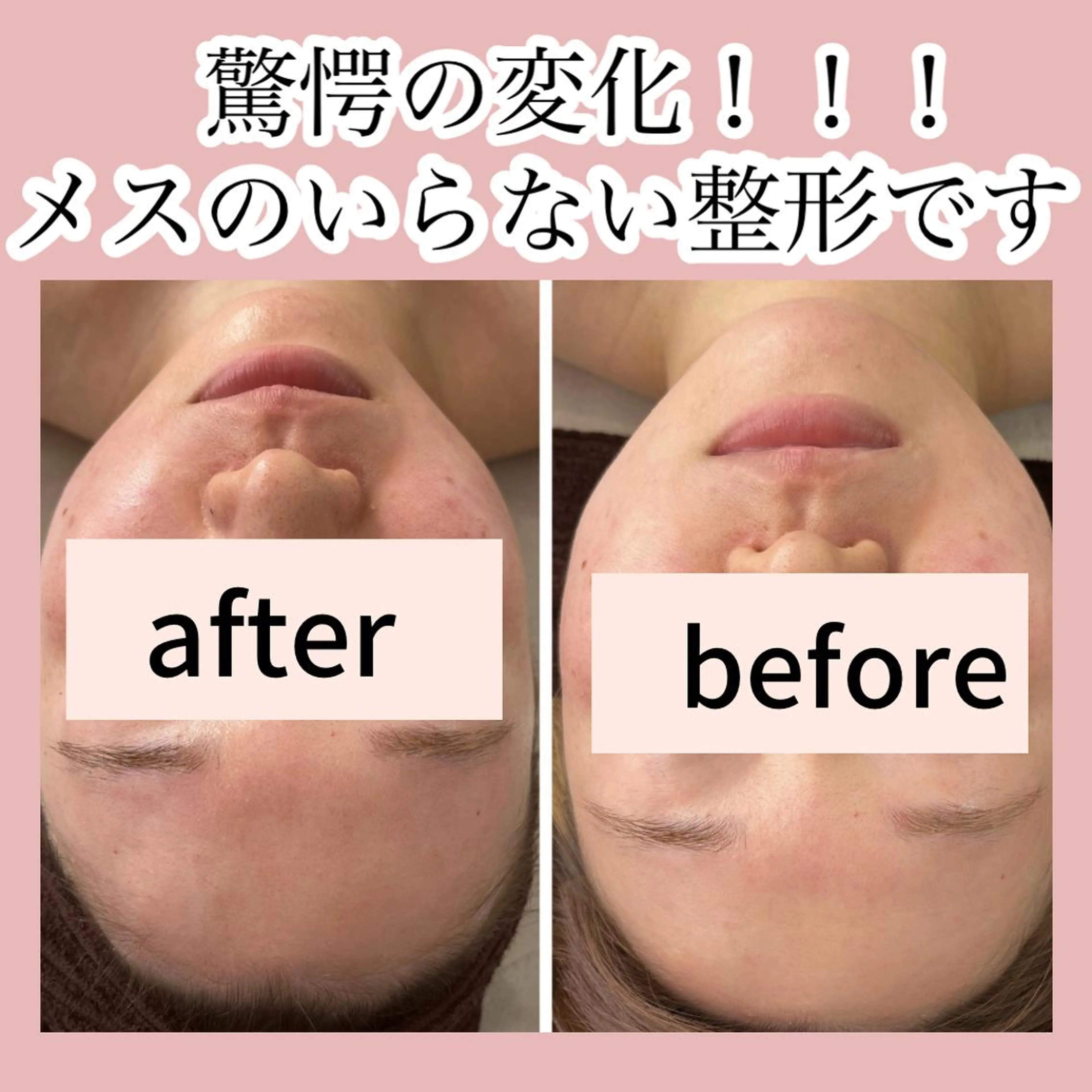 ■超絶小顔＆肌管理室■所属・🦋整形級の究極美顔 本格韓国式小顔🦋のエステ・リラクイメージ