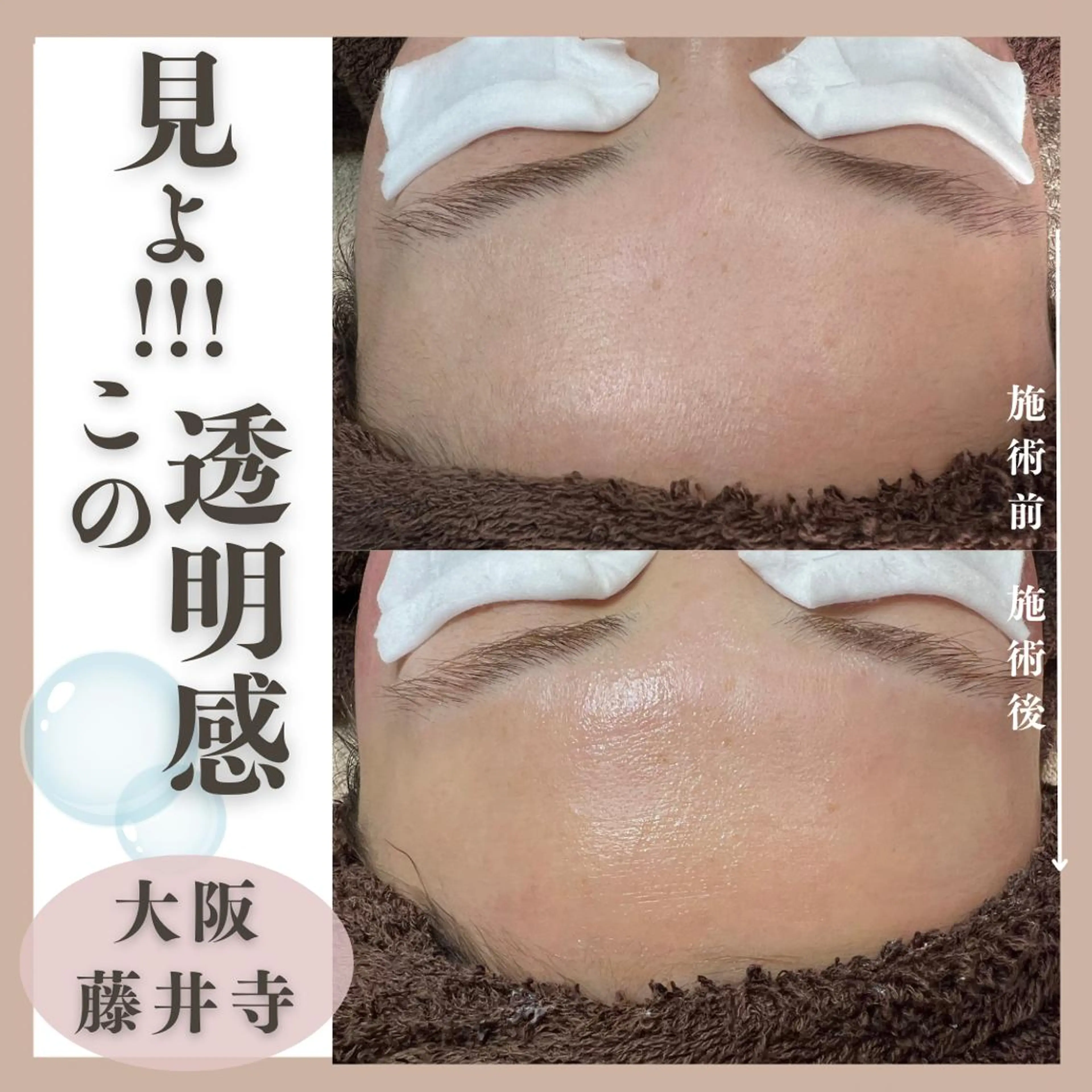 Muqu.所属・Muqu. 毛穴サロンのエステ・リラクイメージ