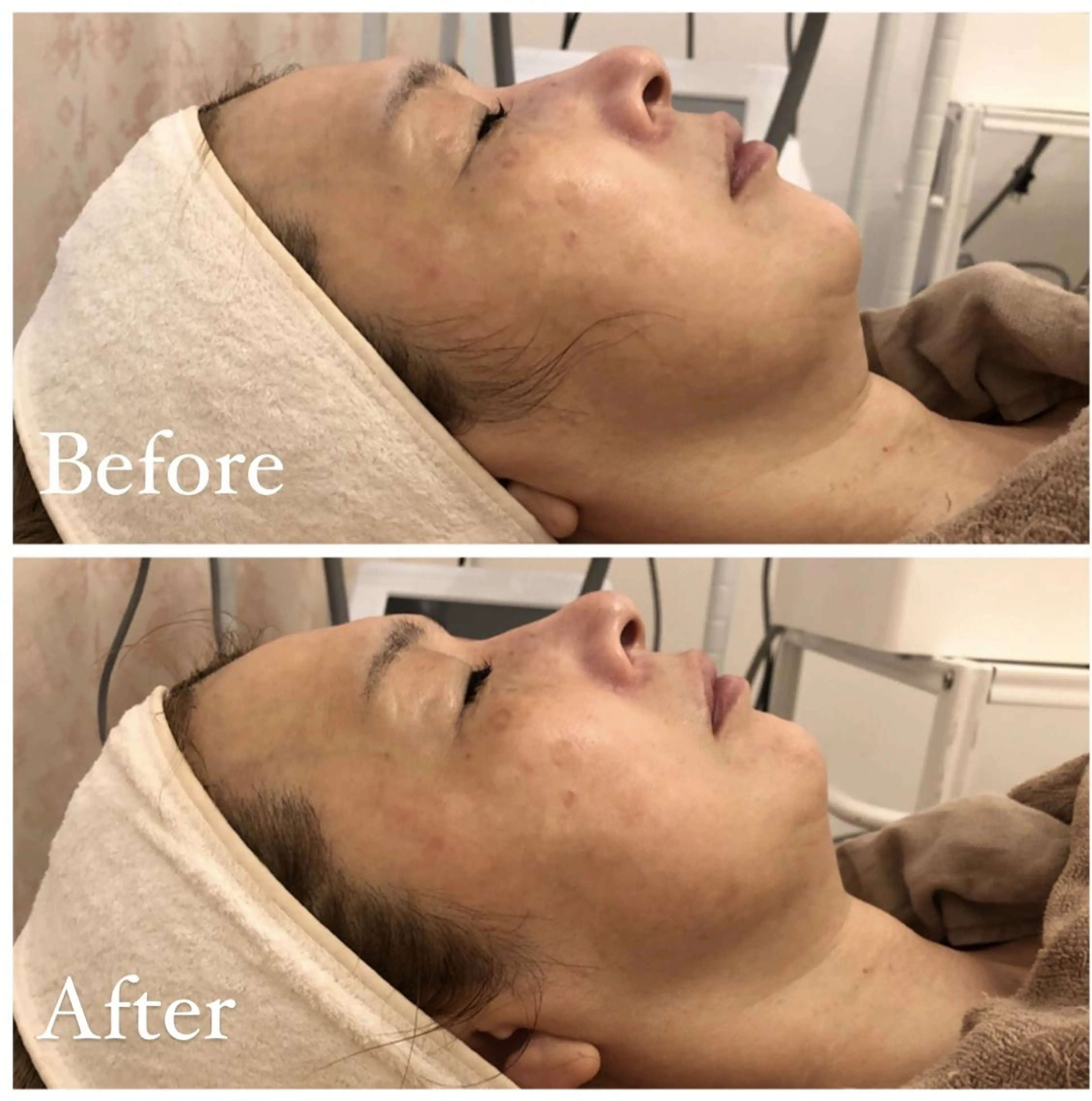 ✨美肌水光✨ アトリエリュバンのエステ・リラクイメージ