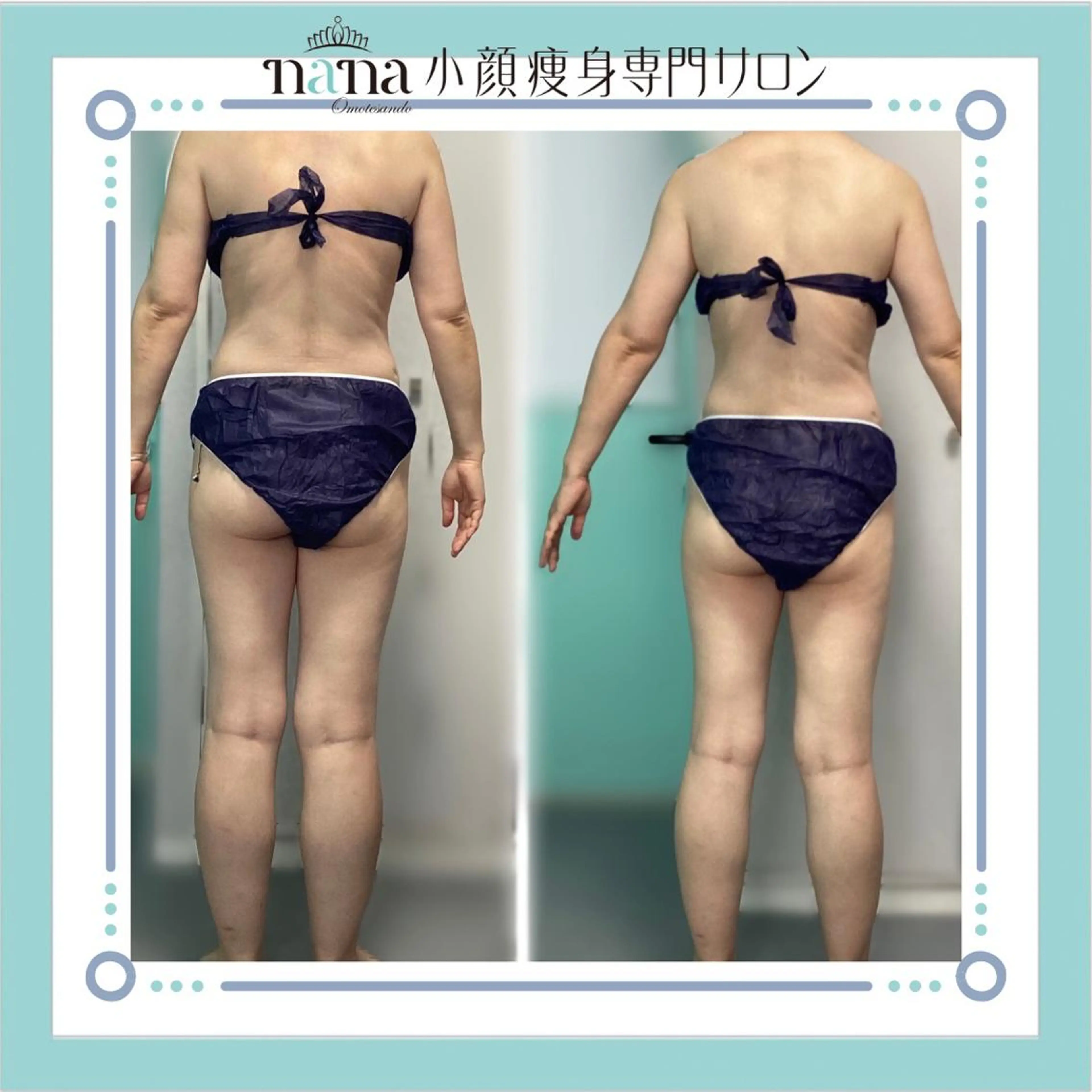 小顔痩身インディバ Nana表参道のエステ・リラクイメージ