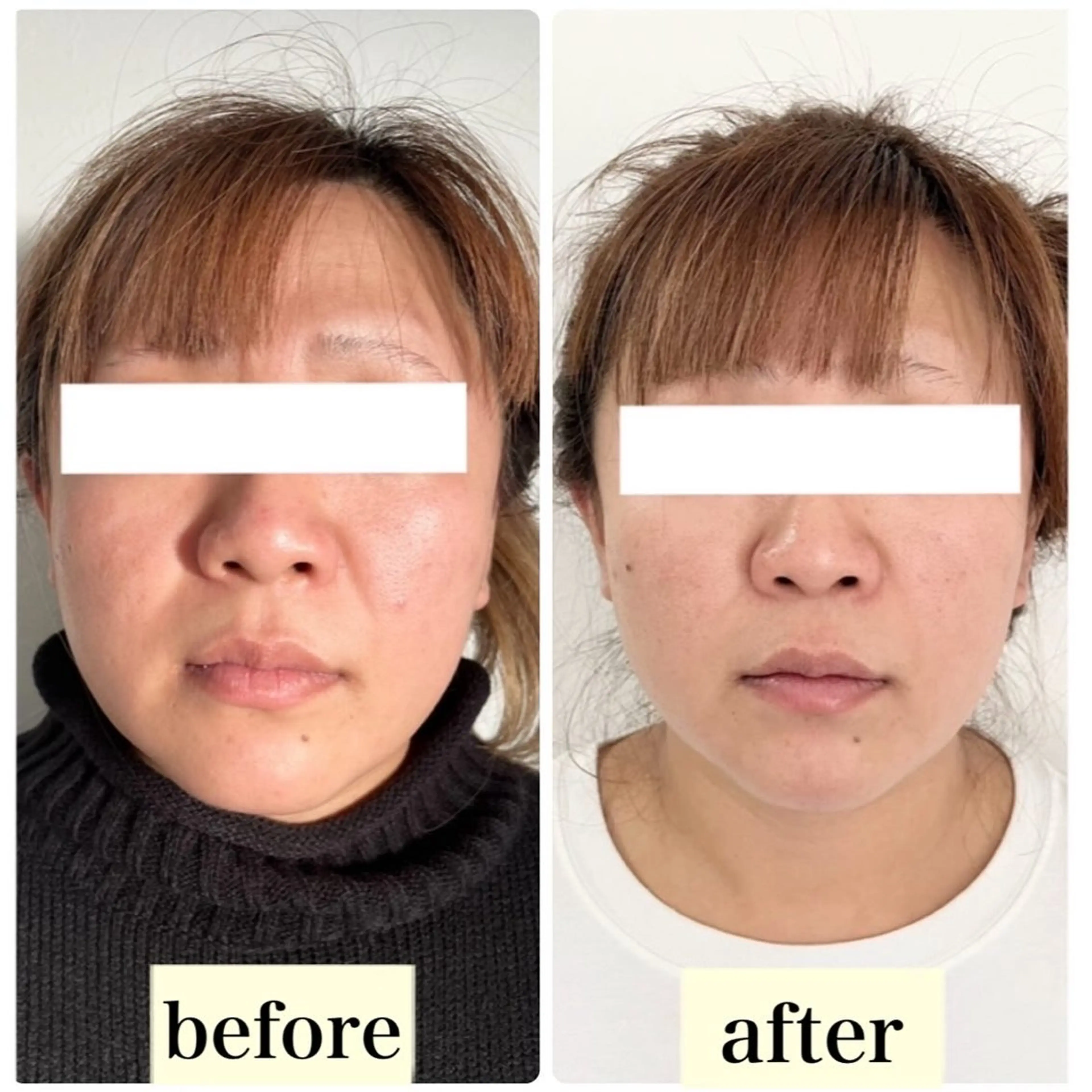 エステ リラク ルコナビューティ所属・小顔・歪み専門　井元 朋子のエステ・リラクイメージ